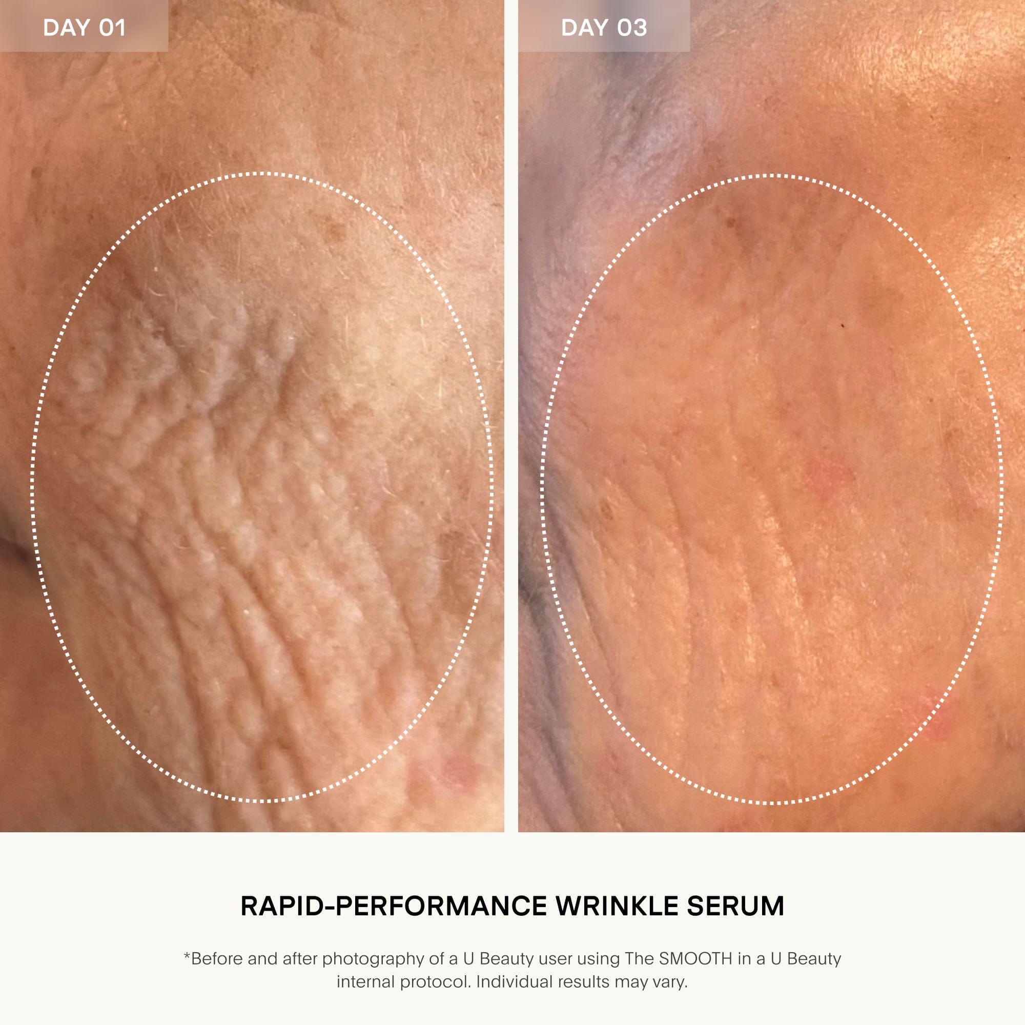 U Beauty The SMOOTH Dynamic Wrinkle Defense Serum