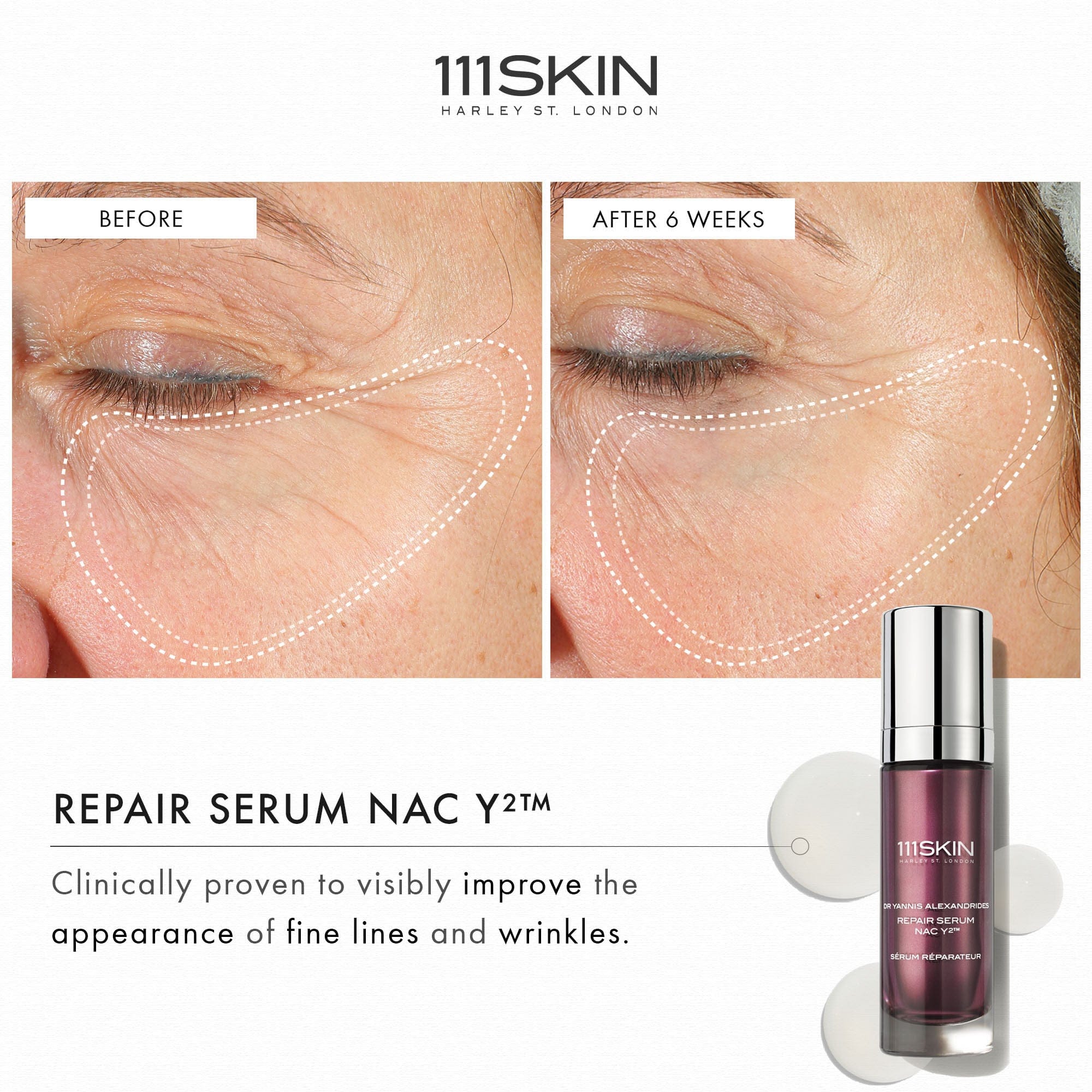 111skin Repair Serum NAC Y2