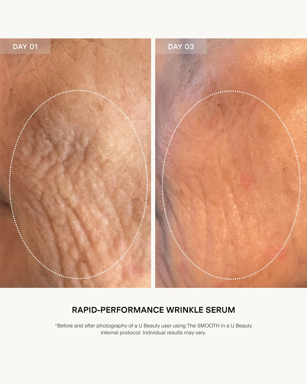 Ubeauty The Smooth Dynamic Wrinkle Defense Serum