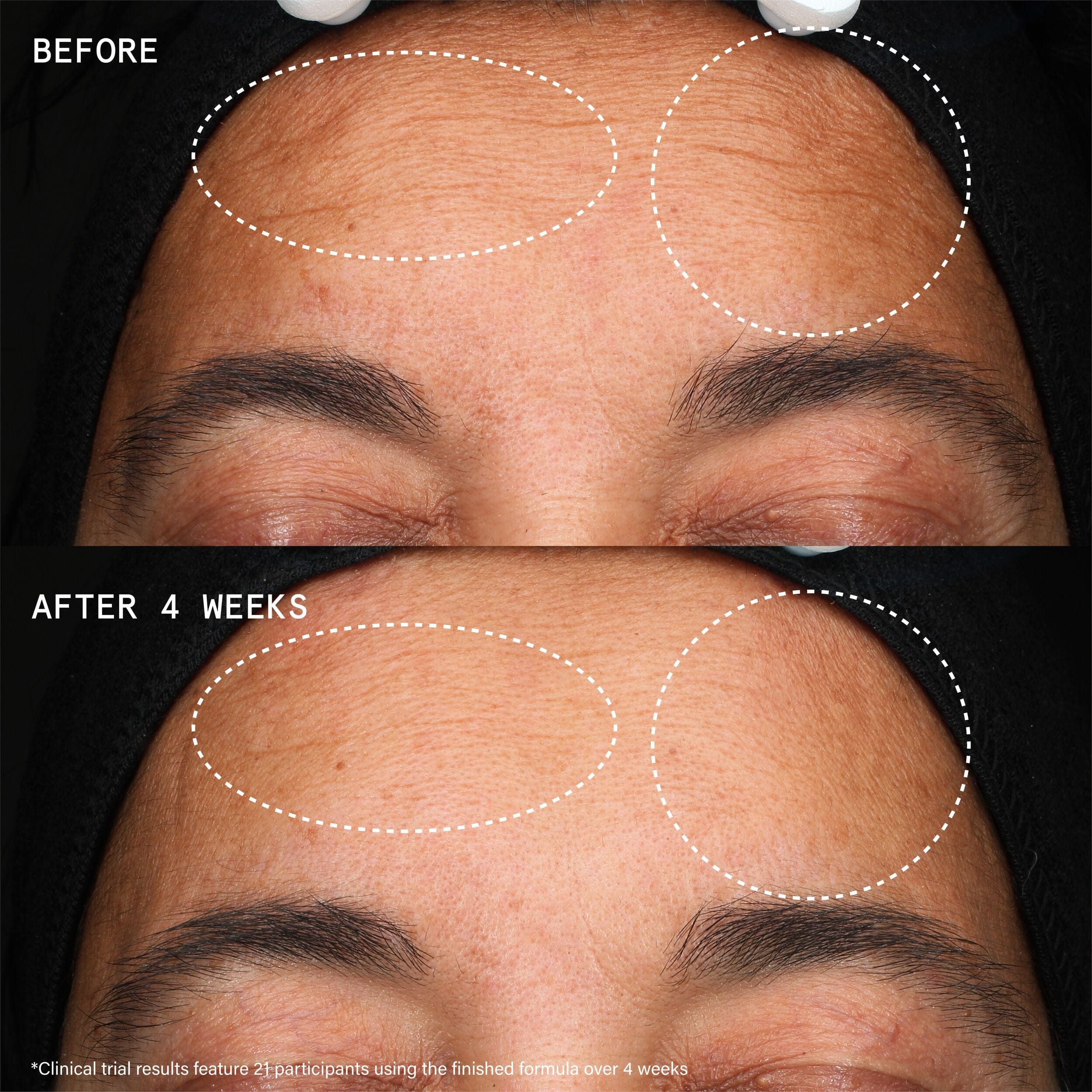 Beauty Pie Youthbomb Extreme Retinal Serum - 5% Power Complex of Retinoid + Retinal + Bio - Bakuchiol
