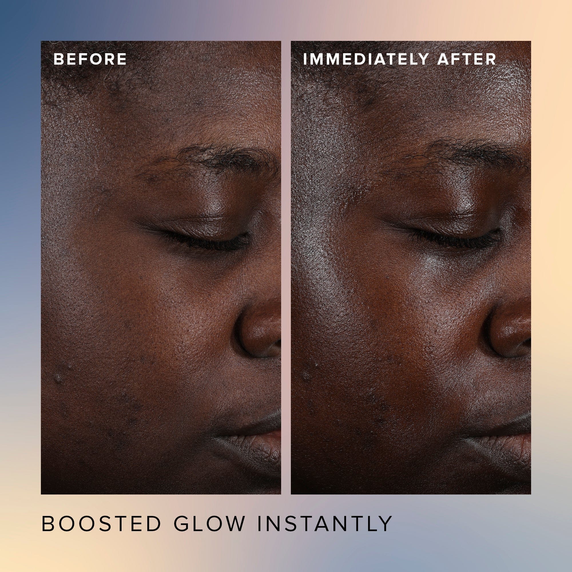 ACID Honey Glow 17% AHA + BHA Resurfacing Acid Serum