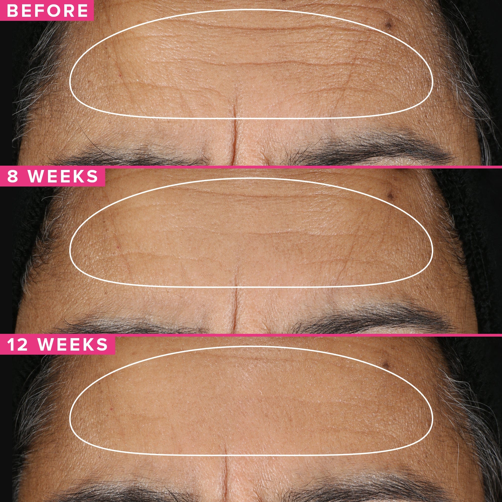 Farmacy Beauty 1% Vitamin A Retinol Serum