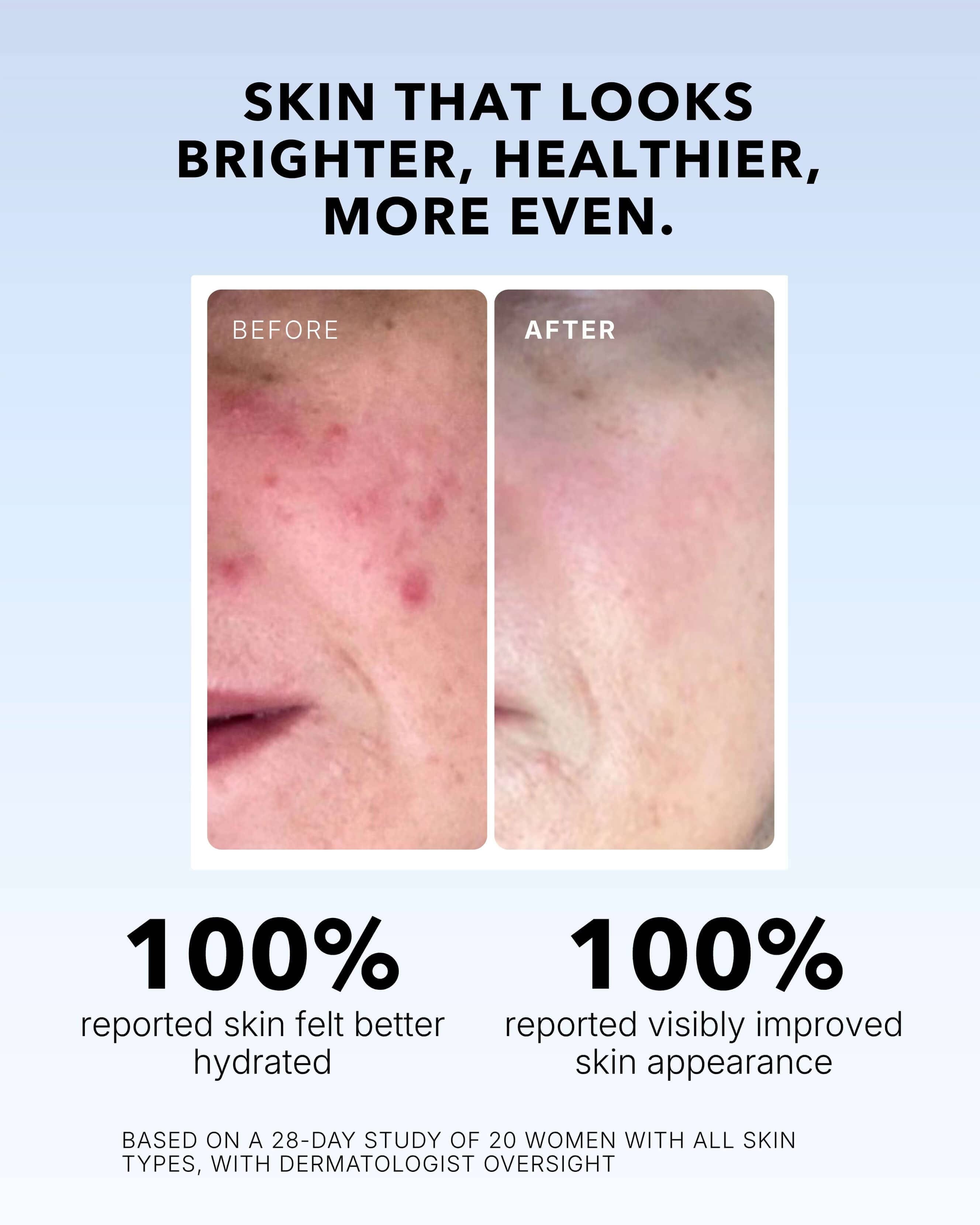 Skin Diligent Vitamin C Serum In Oil