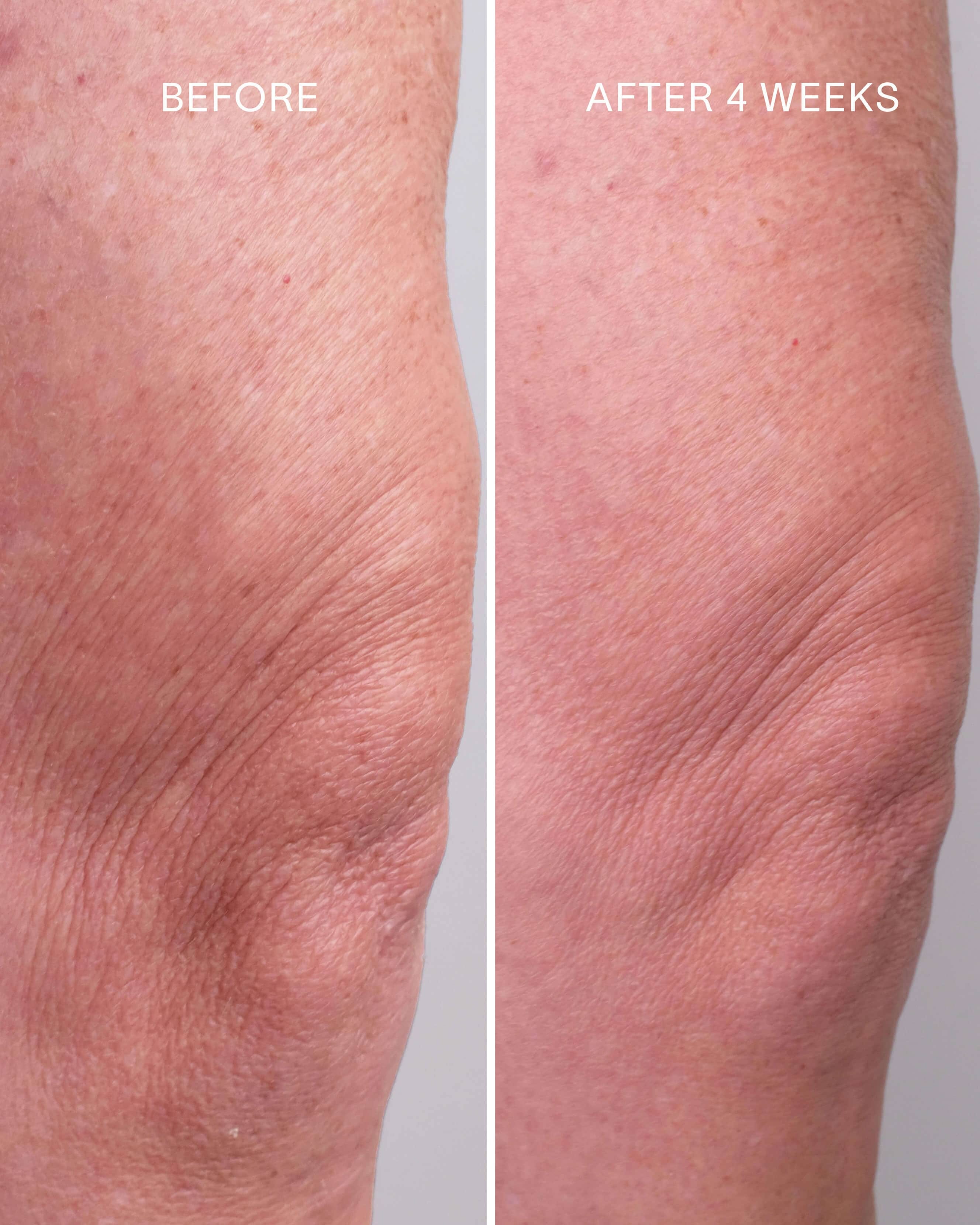 Doctor Rogers Glycolic + Bakuchiol Smoothing Body Treatment