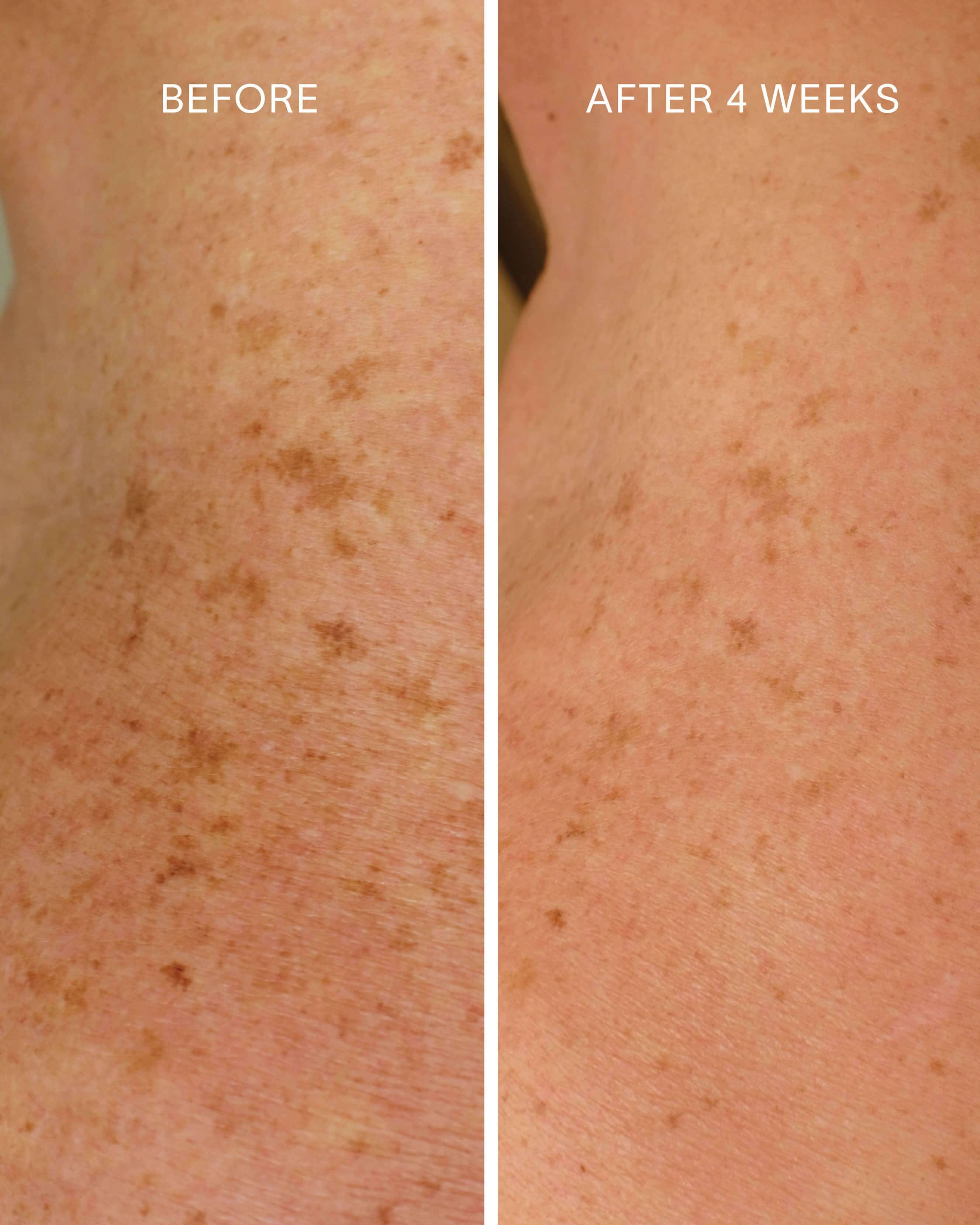 Doctor Rogers Glycolic + Bakuchiol Smoothing Body Treatment