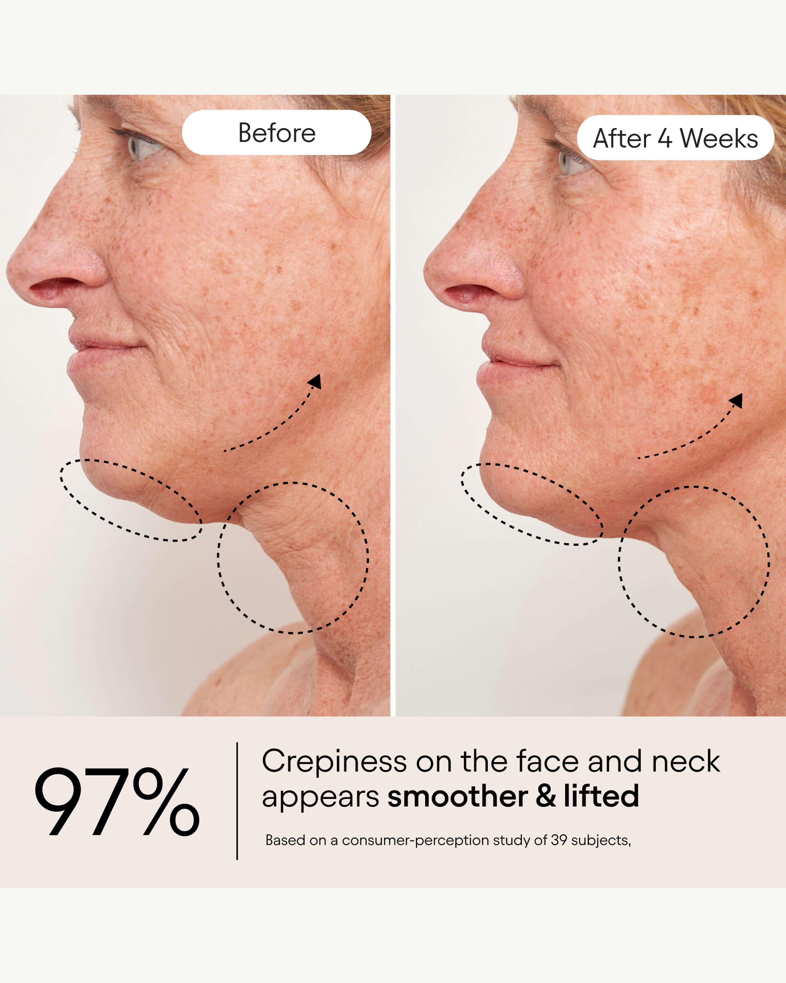 Alpyn Beauty Super Sculpt Serum For Face & Neck