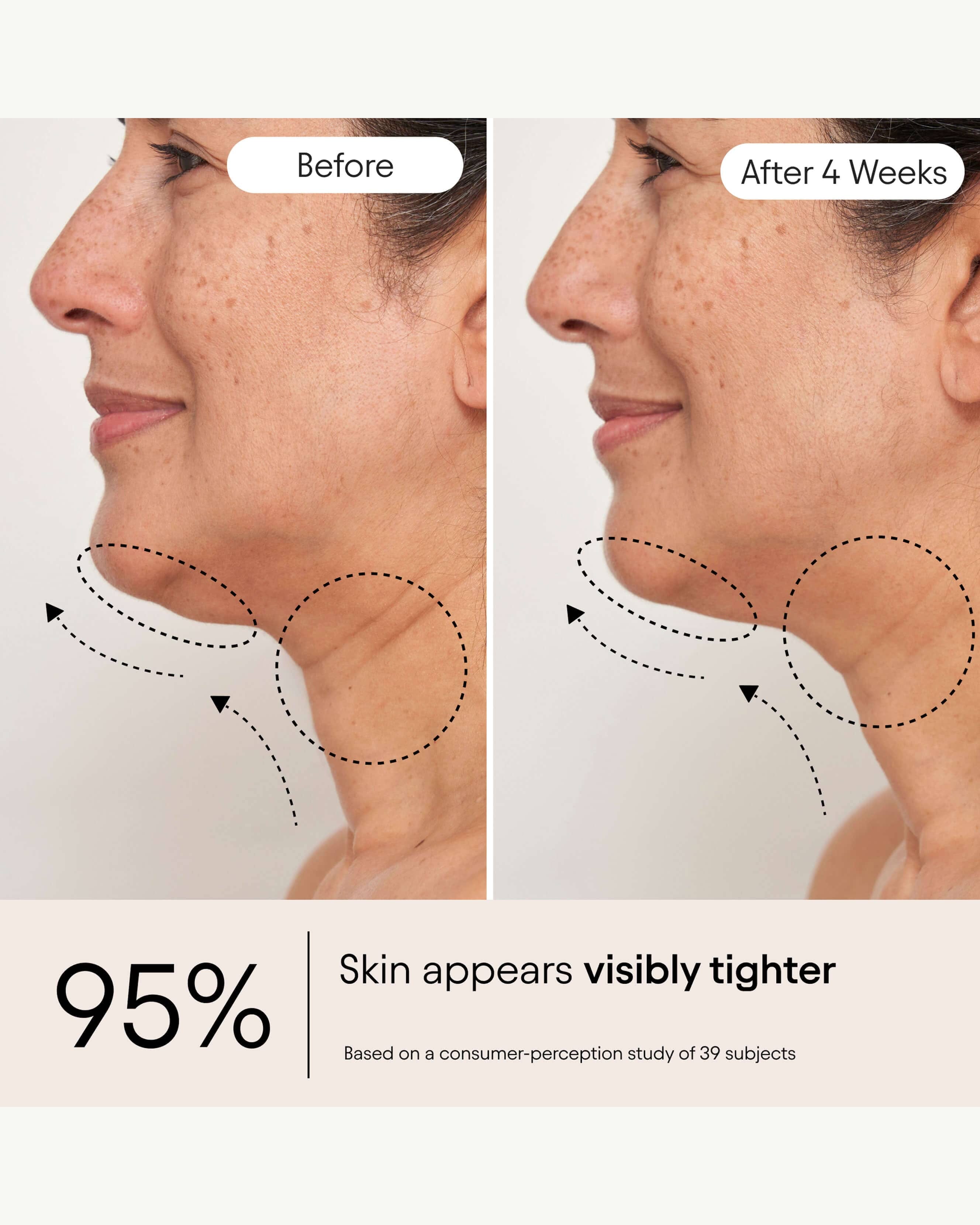 Alpyn Beauty Super Sculpt Serum For Face & Neck