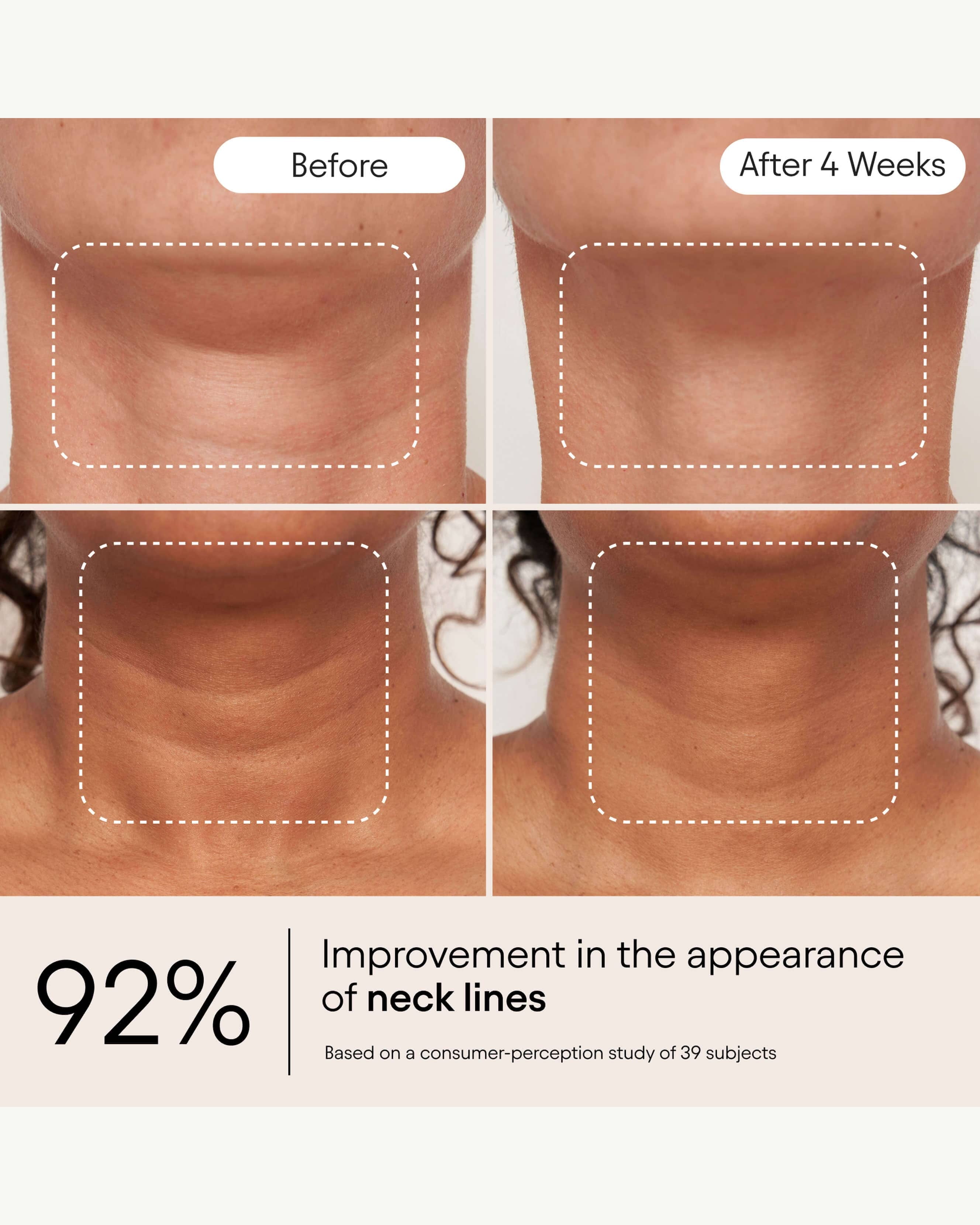 Alpyn Beauty Super Sculpt Serum For Face & Neck