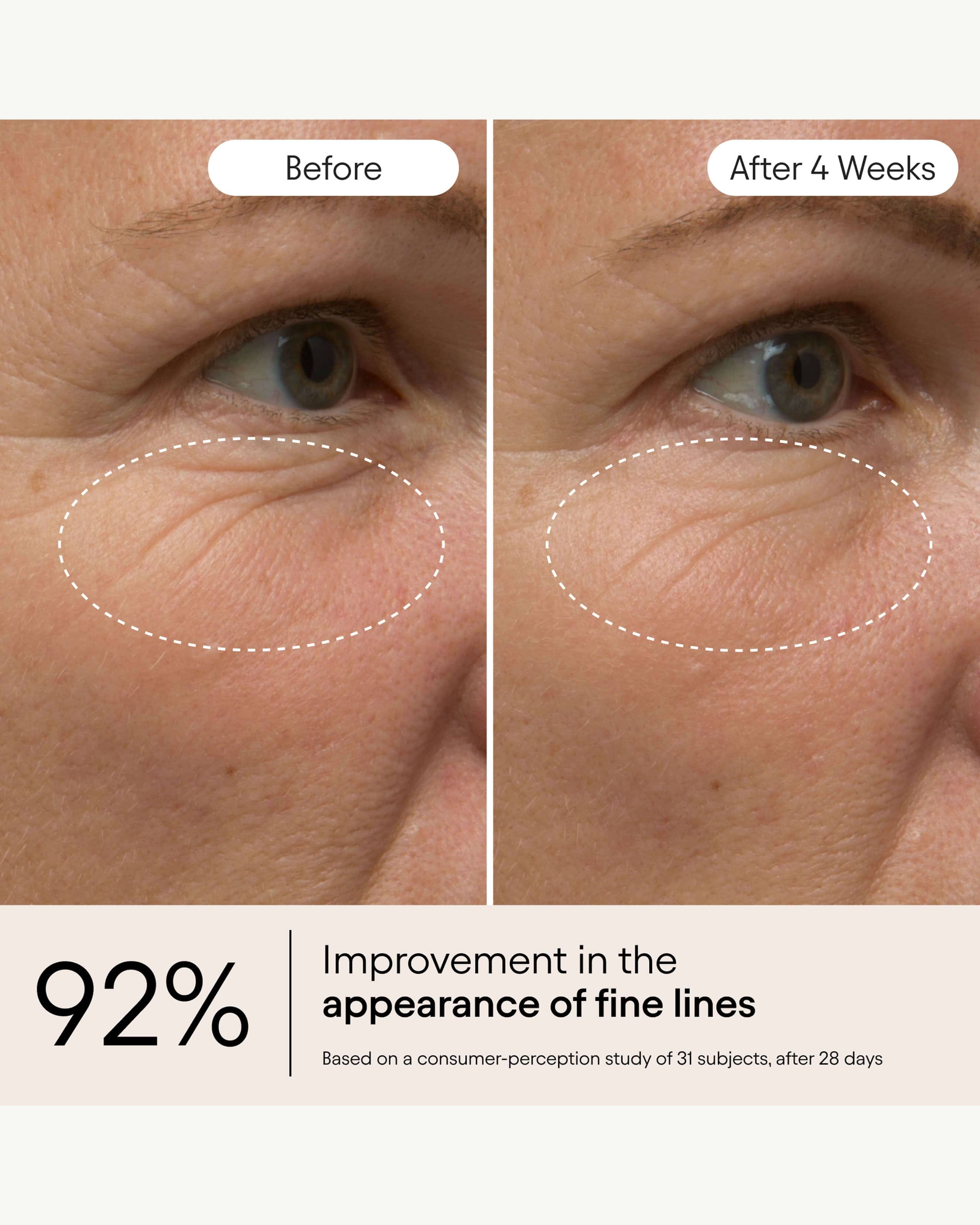 Alpyn Beauty Line - Filling Eye Balm
