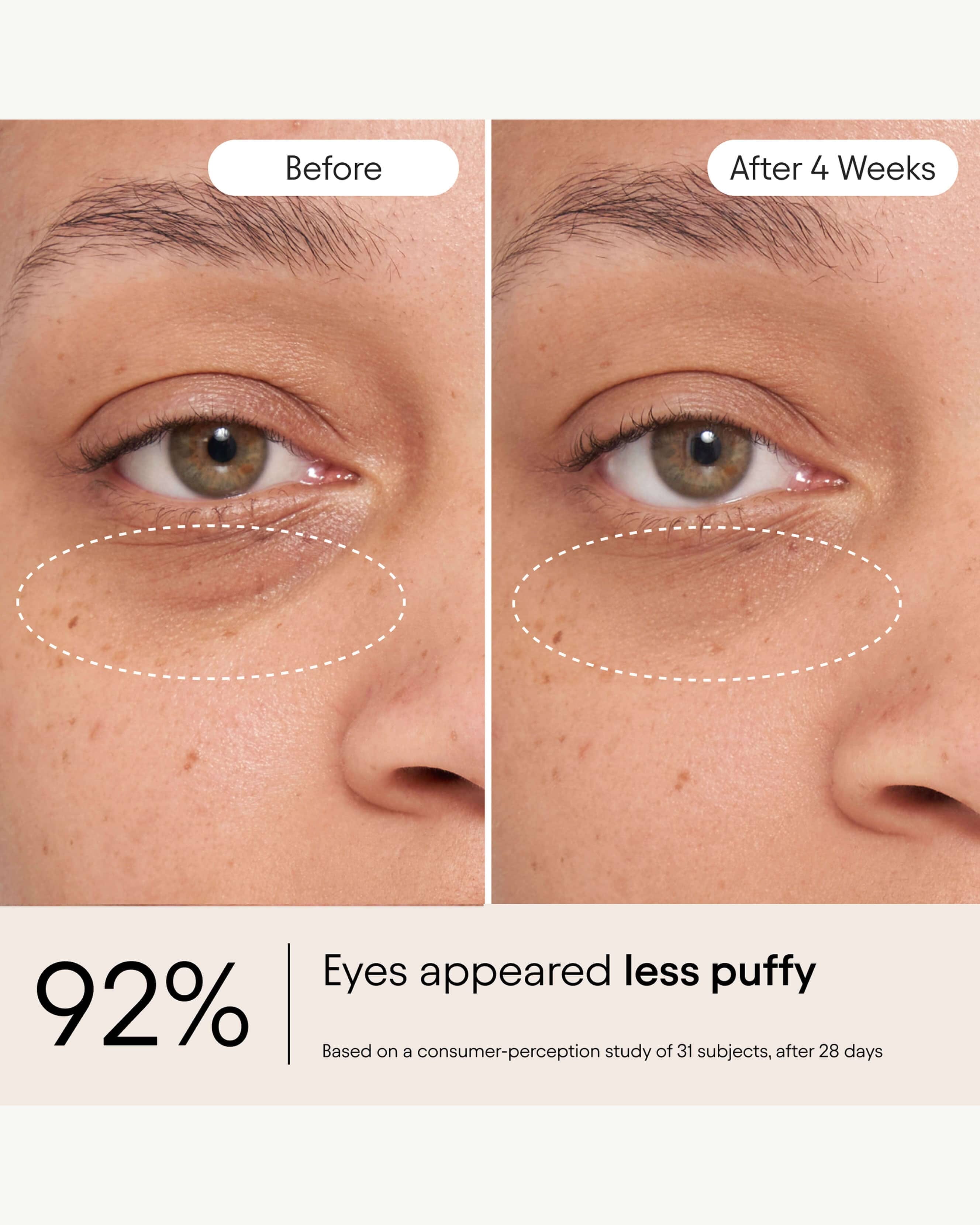 Alpyn Beauty Line - Filling Eye Balm