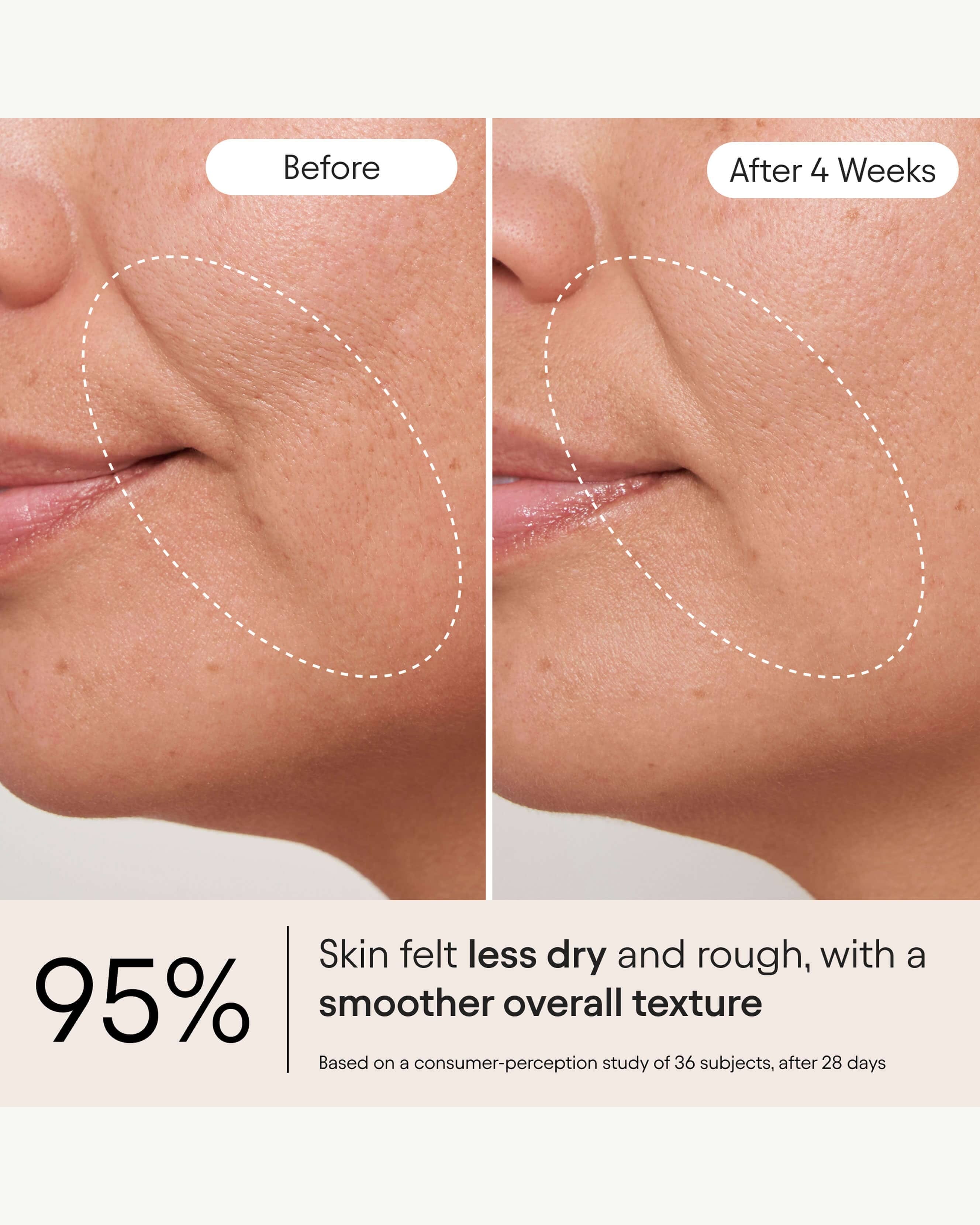Alpyn Beauty Melt Moisturizer