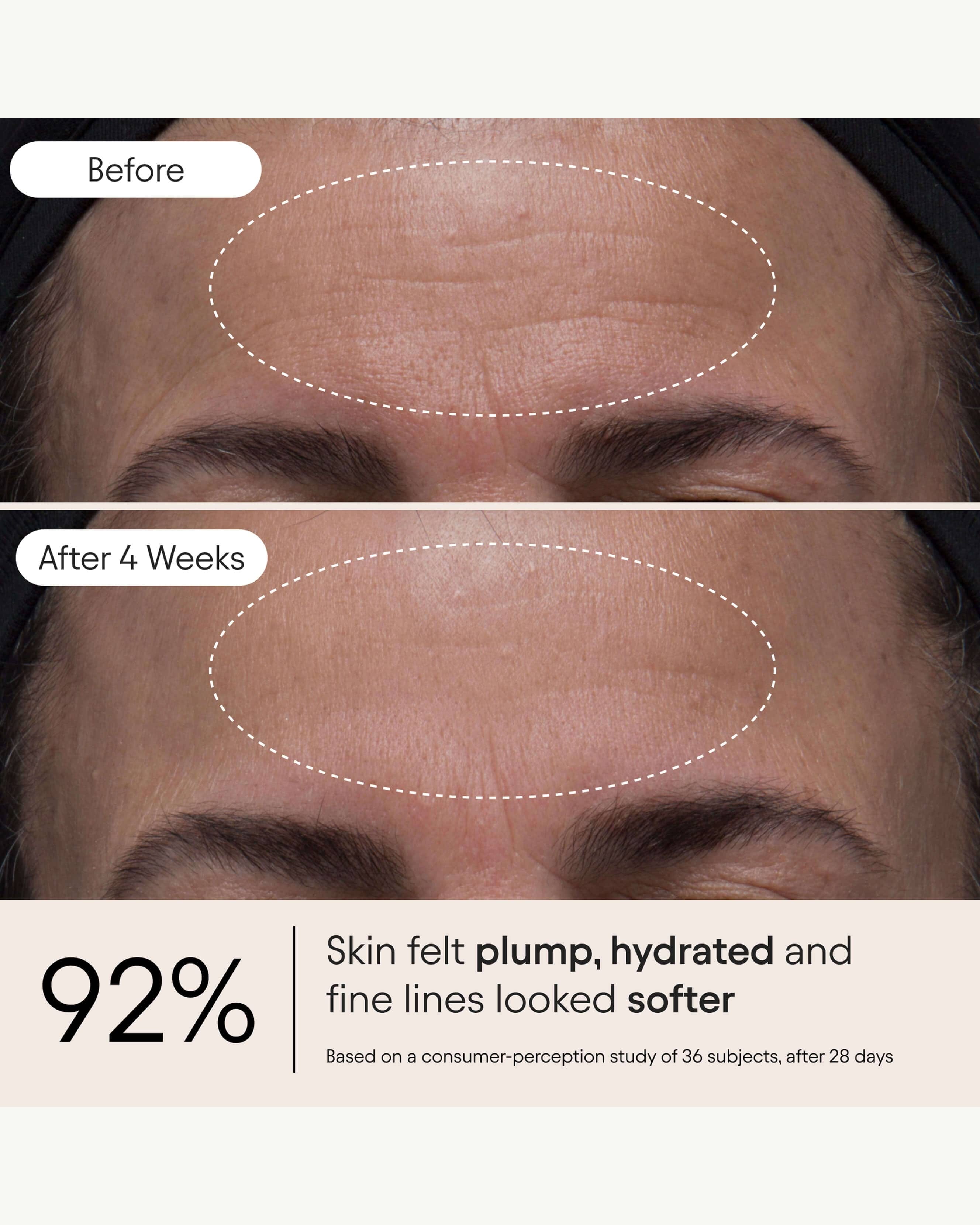 Alpyn Beauty Melt Moisturizer