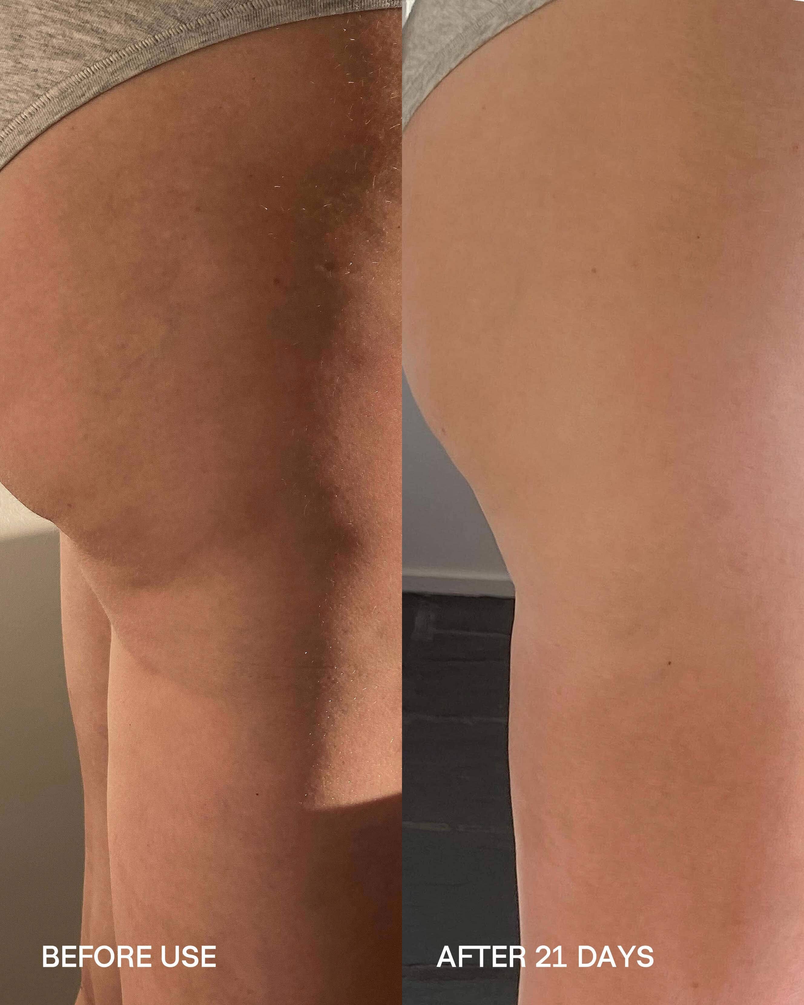 Biotyspa Body Sculpt Cup
