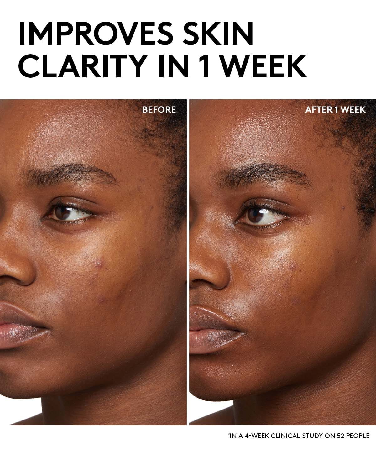 Fenty Skin Start’rs Full - Size Bundle with Mineral SPF: Oily Skin Edition