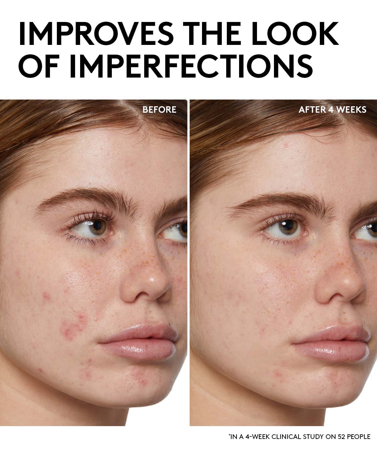 Fenty Skin Start’rs Full - Size Bundle with Mineral SPF: Oily Skin Edition