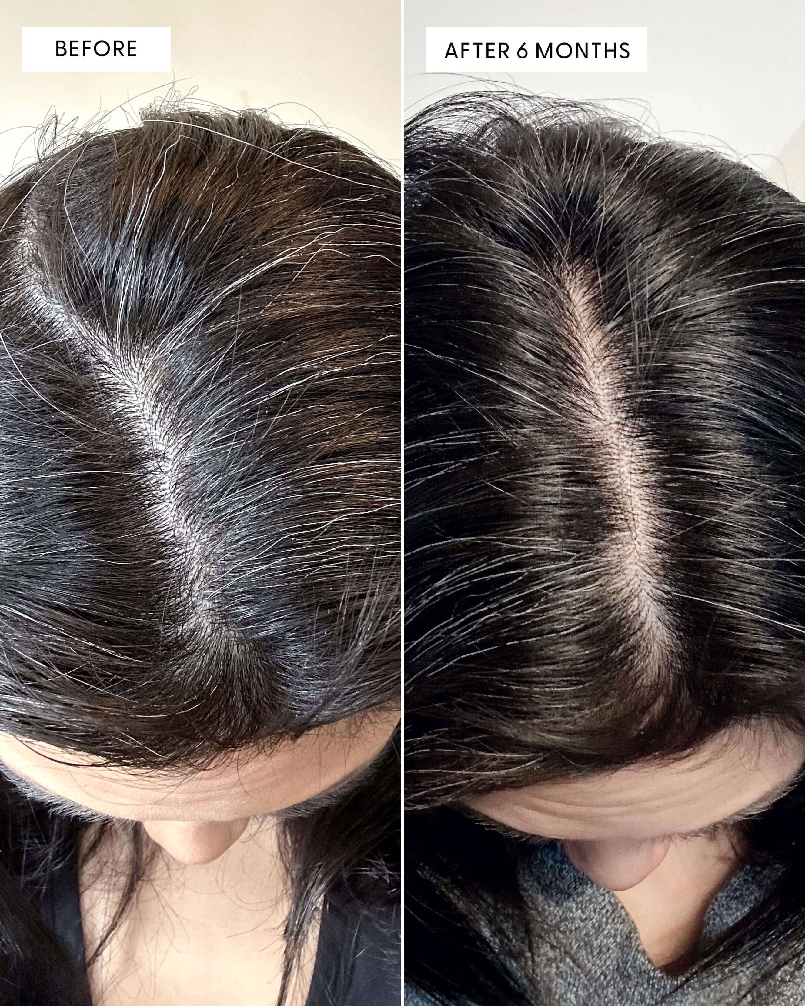 Arey To The Root Serum