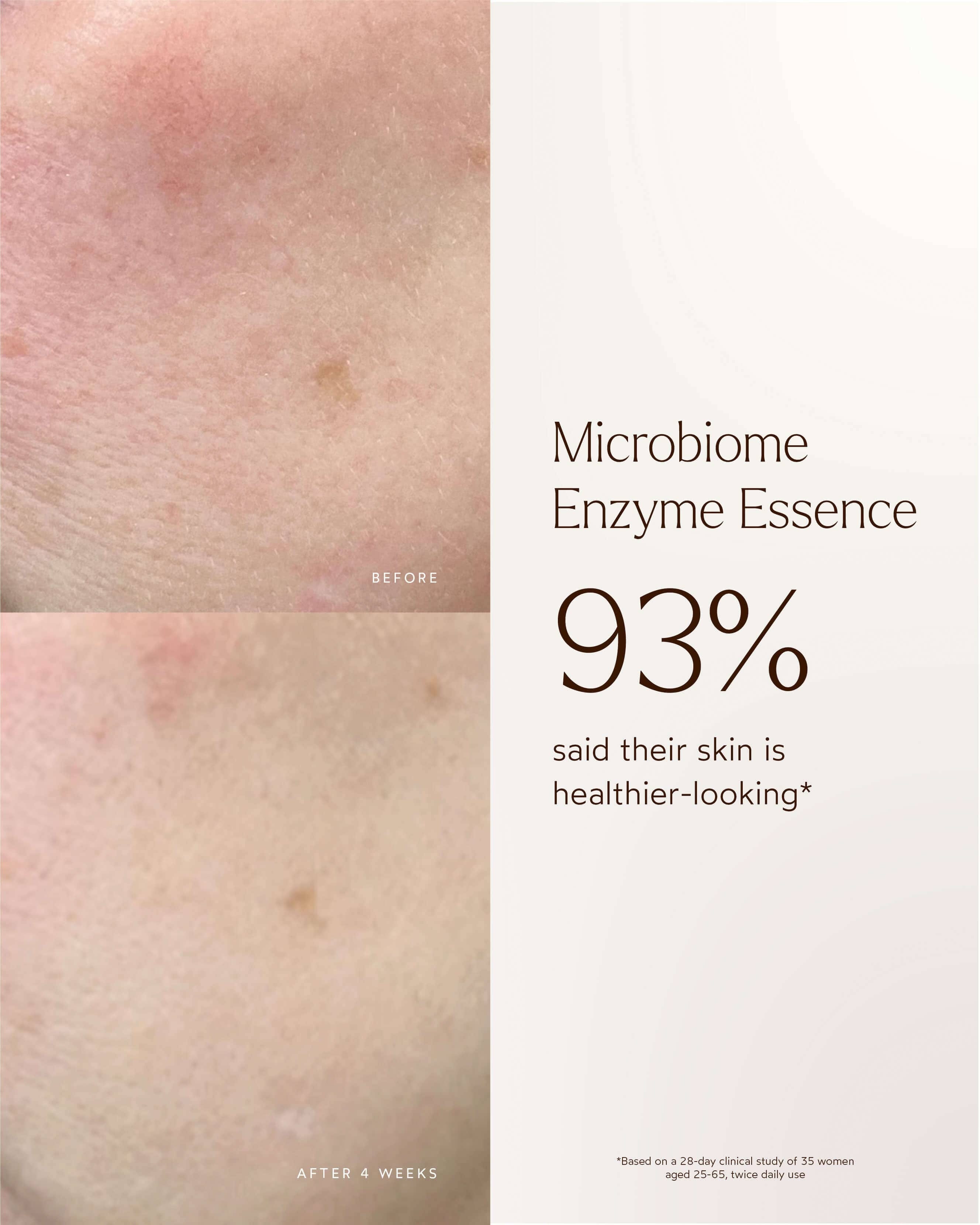 True Botanicals Renew Microbiome Enzyme Essence