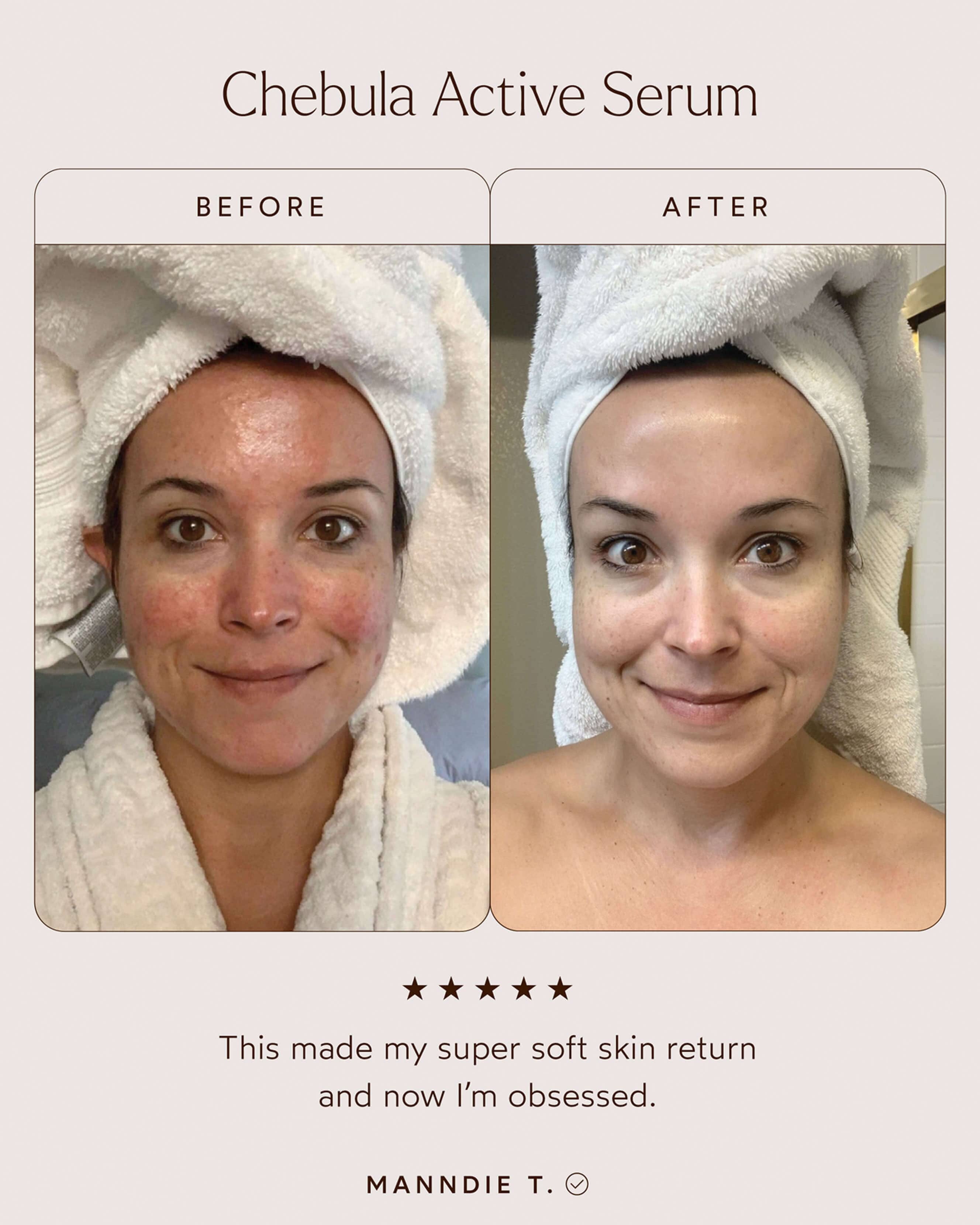True Botanicals Chebula Active Anti - Aging Serum