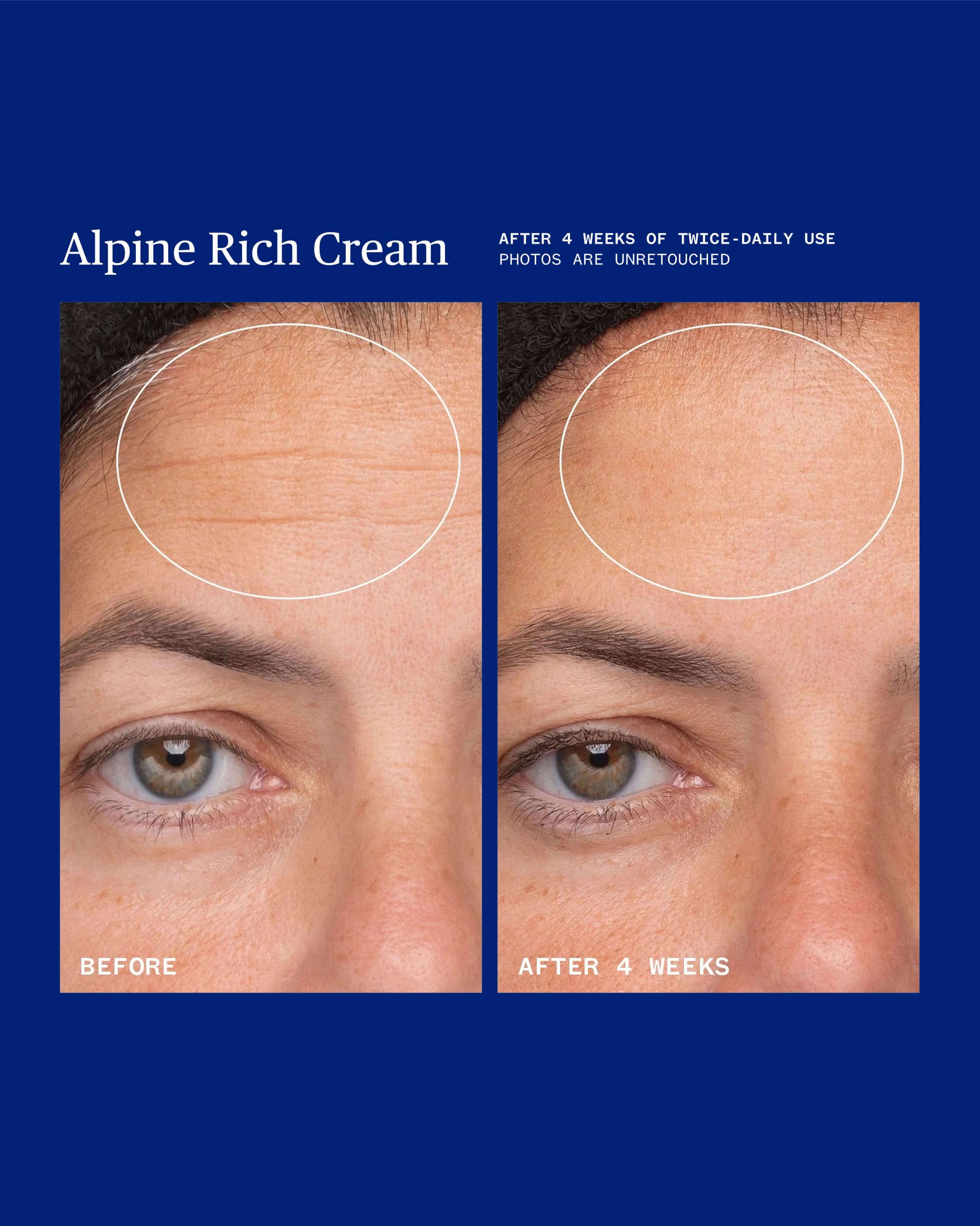 Ursa Major Alpine Rich Cream Barrier Moisturizer for Dry & Sensitive Skin