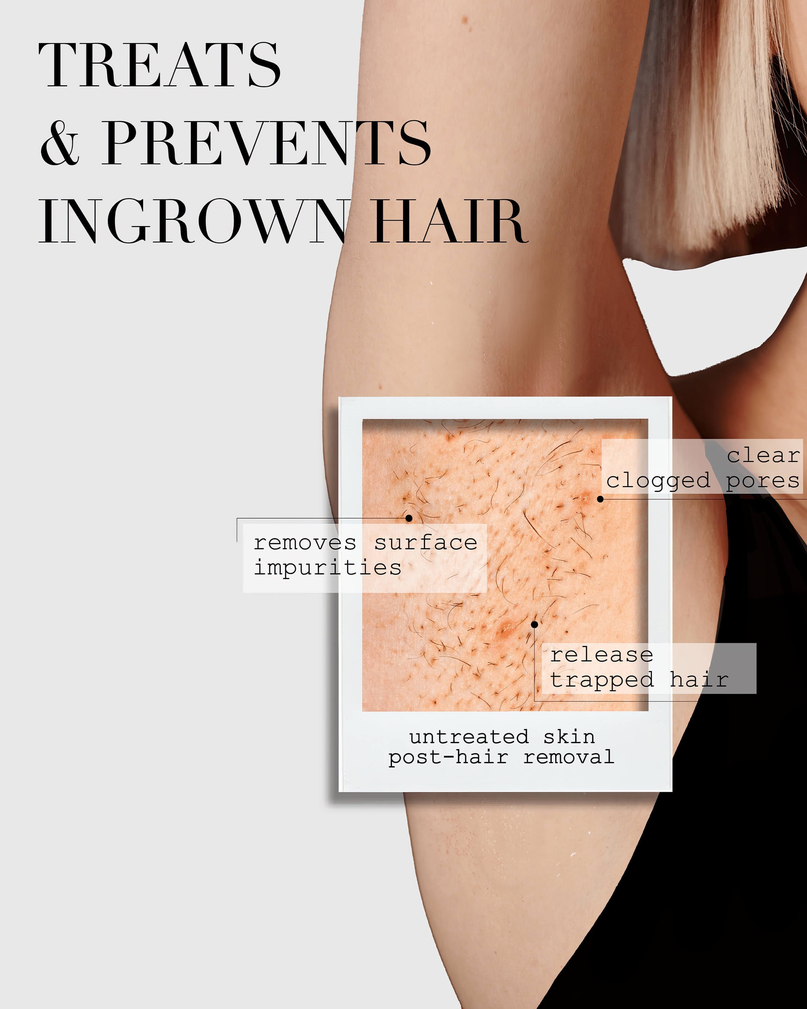 Kaia Naturals The Ingrown Bar