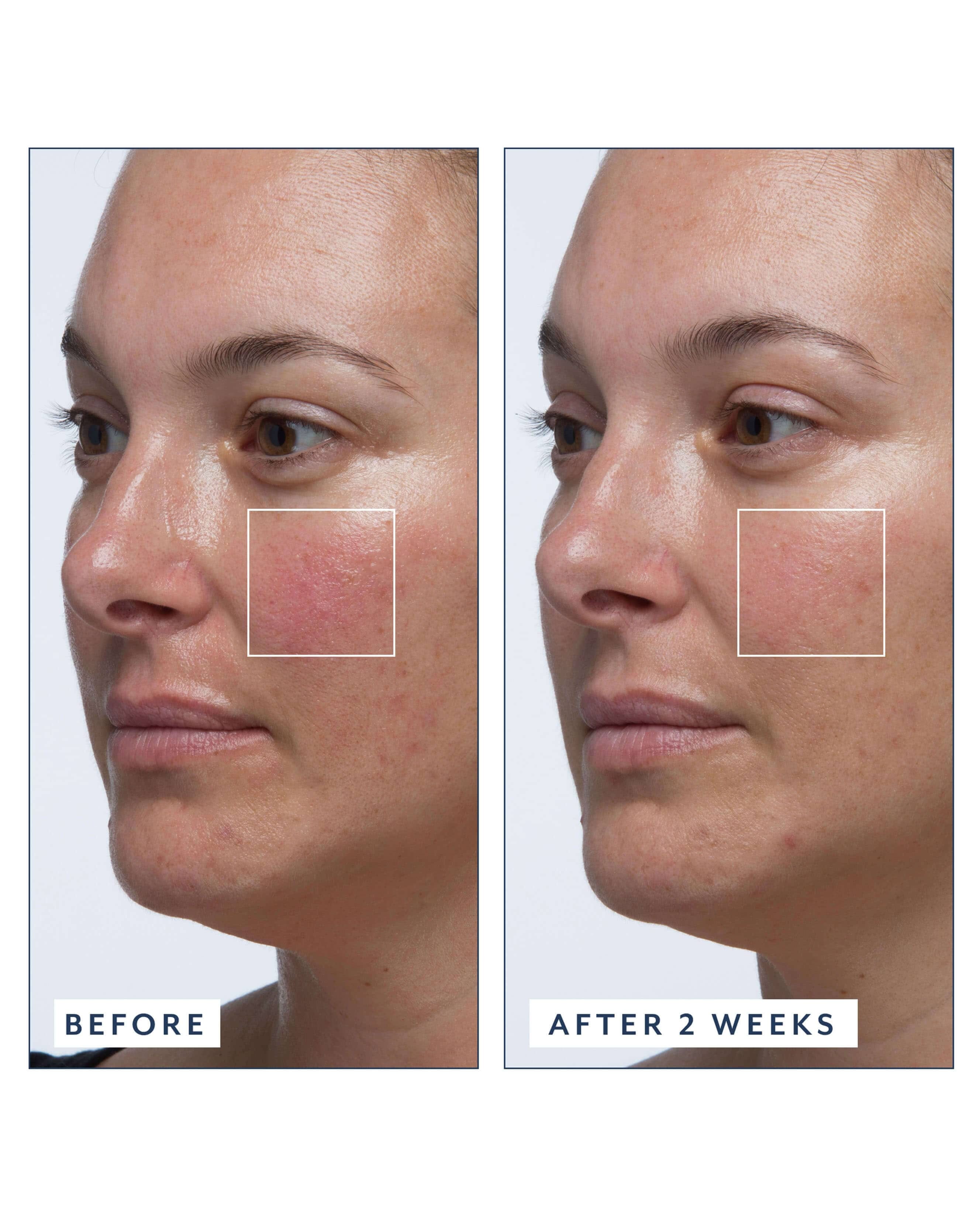 Bloomeffects Royal Tulip Vitamin C Facial Oil