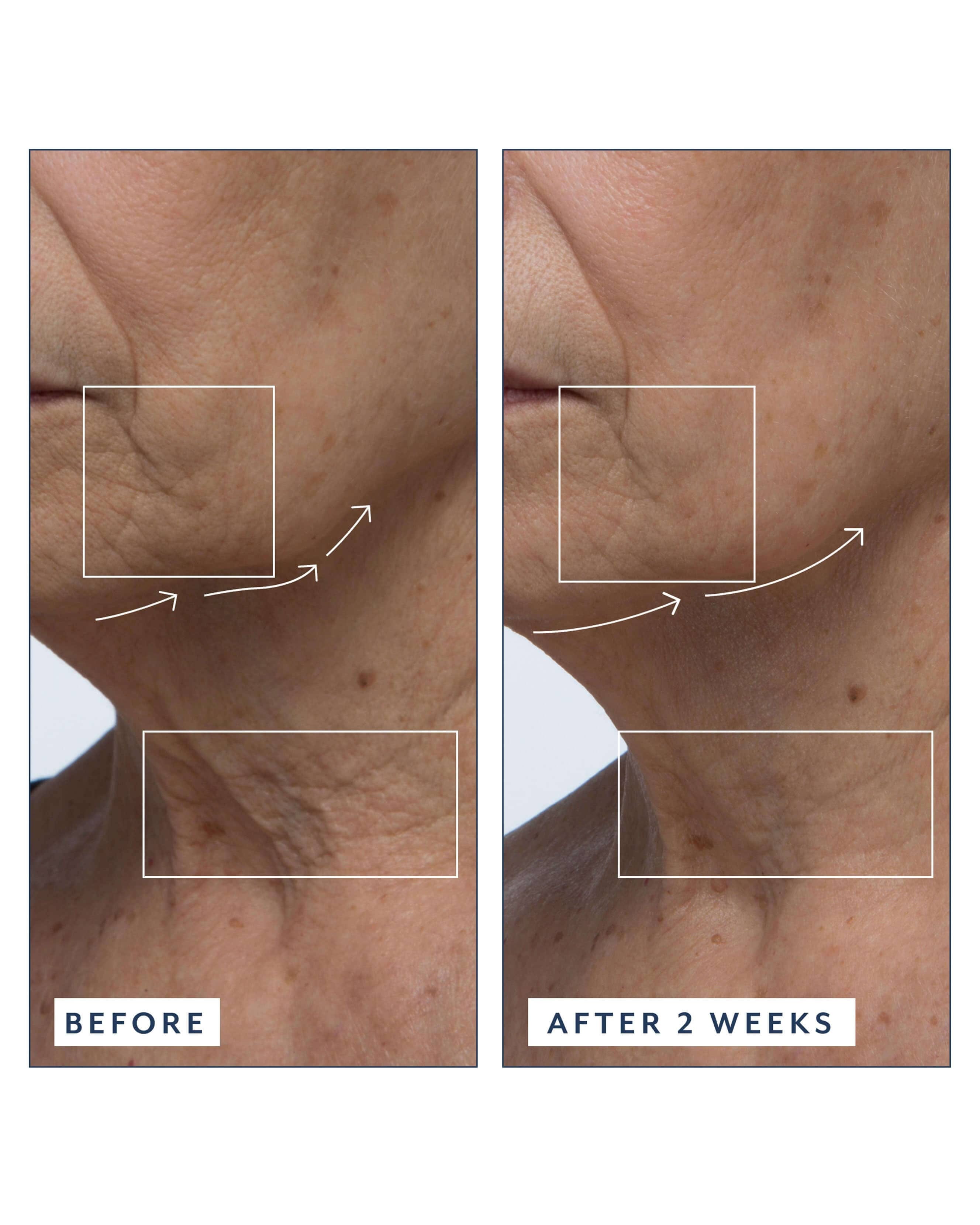 Bloomeffects Royal Tulip Vitamin C Facial Oil