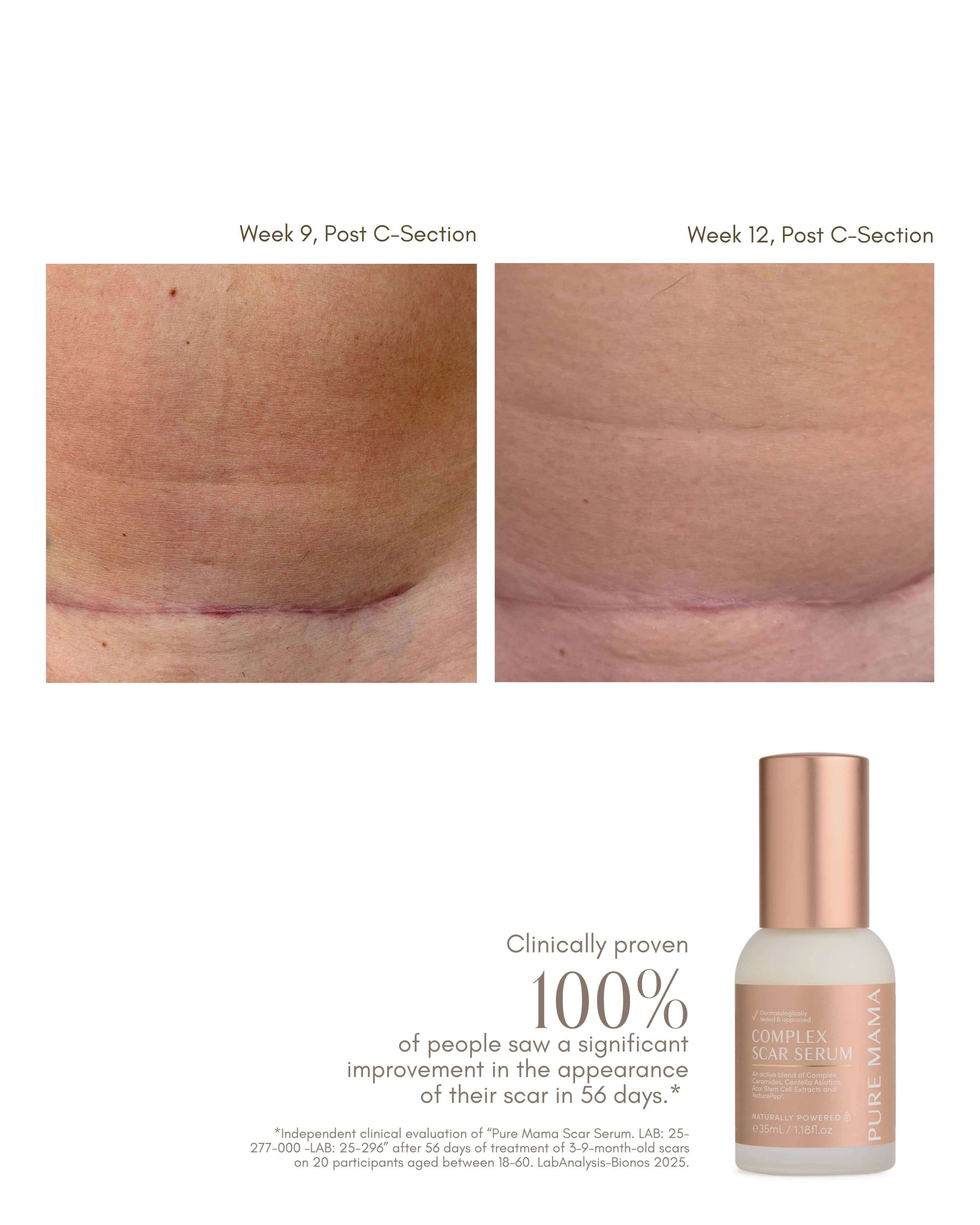 Pure Mama Complex Scar Serum