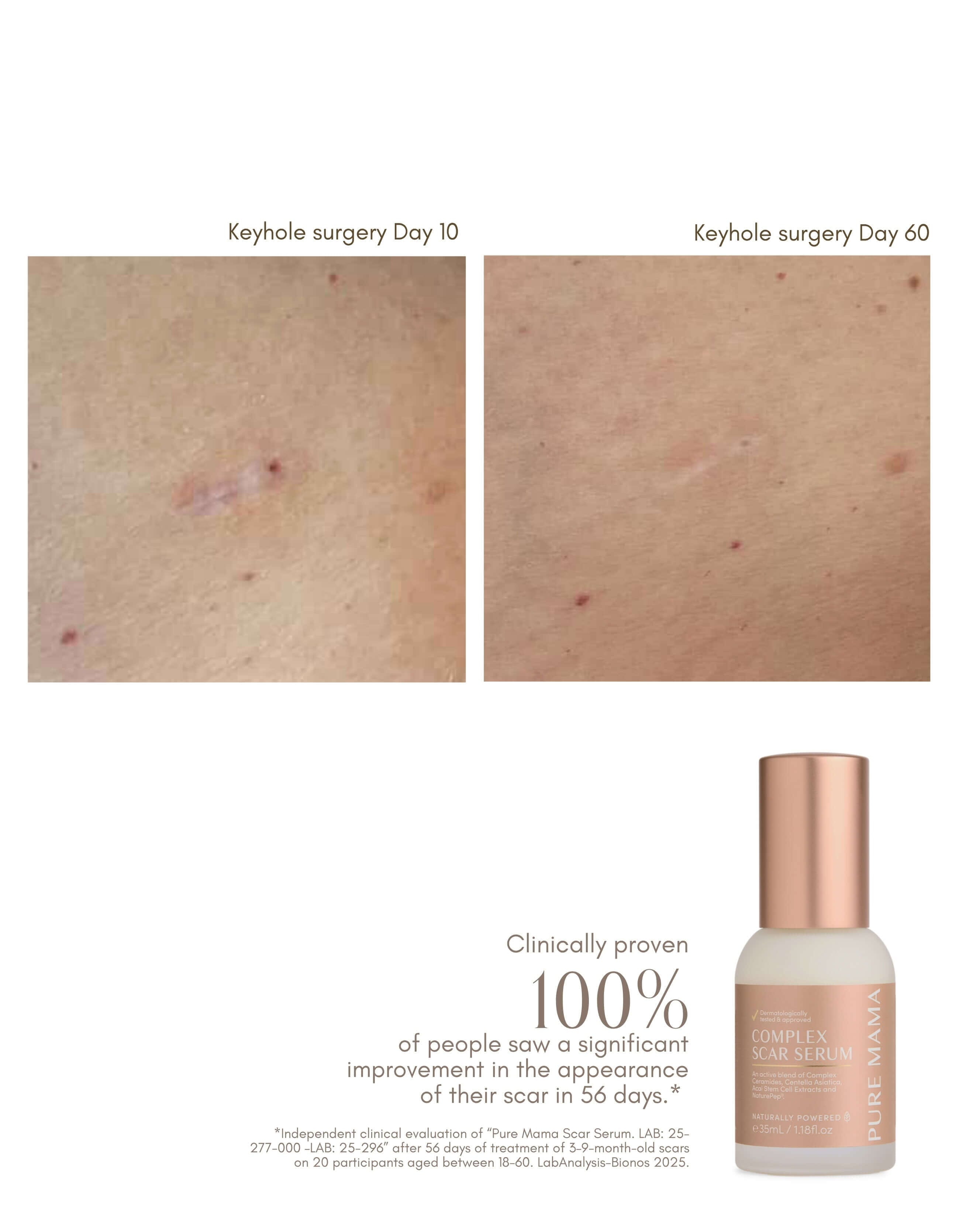 Pure Mama Complex Scar Serum