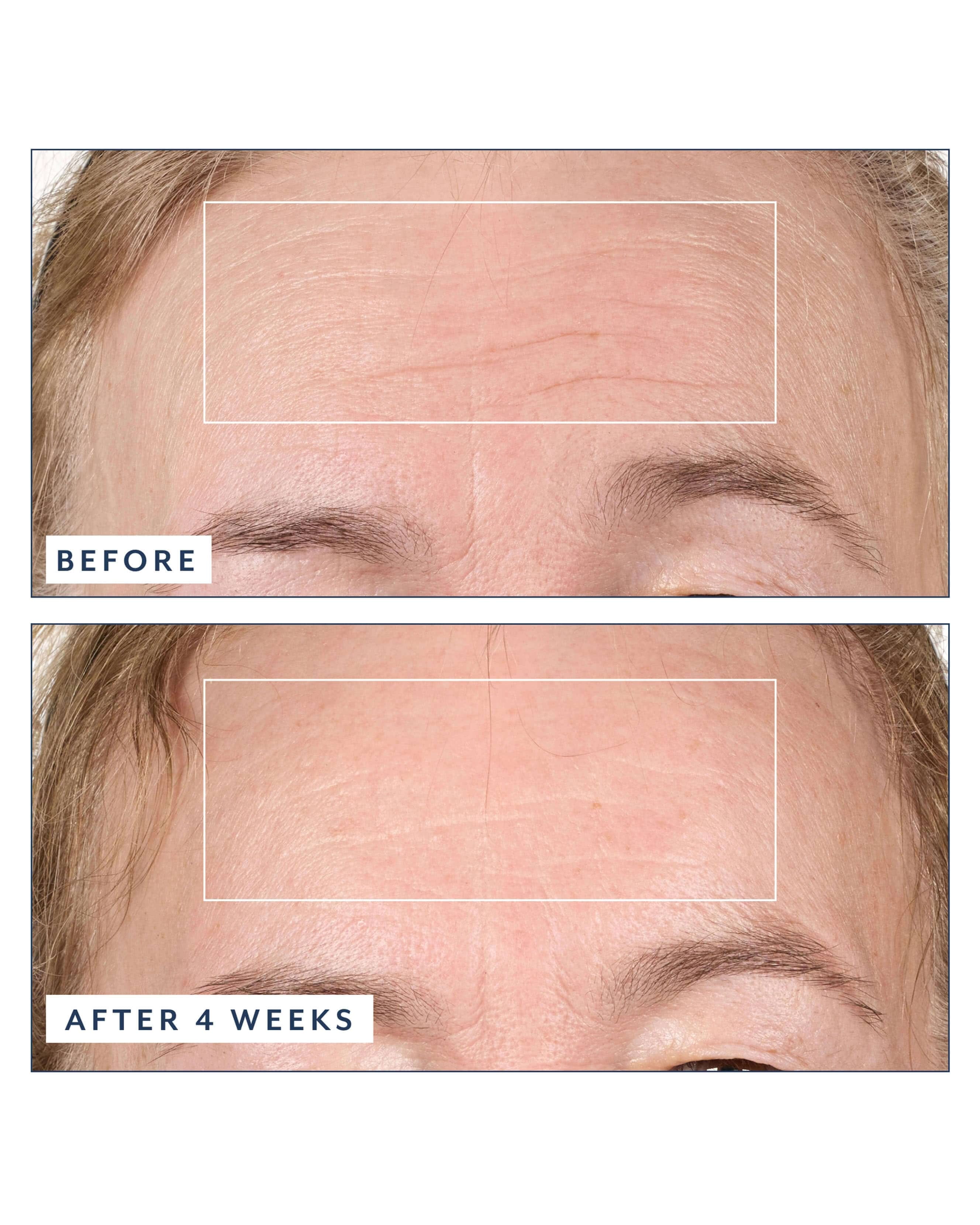 Bloomeffects Black Tulip Regenerative Serum