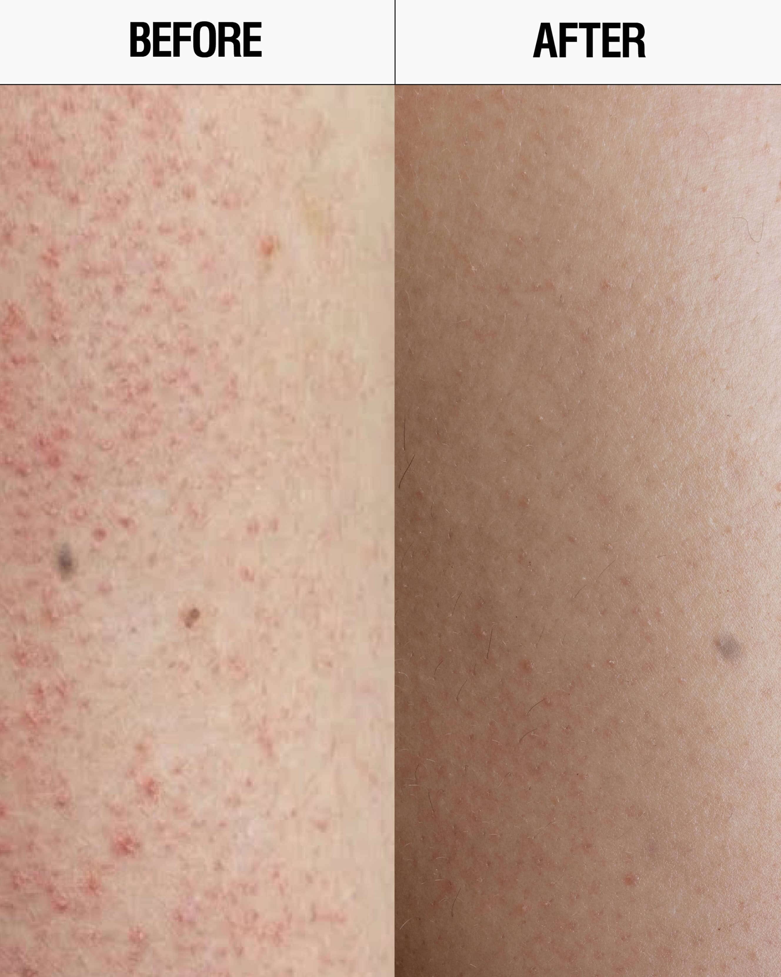 Grown Alchemist Resurfacing Targeted Body Cleanser