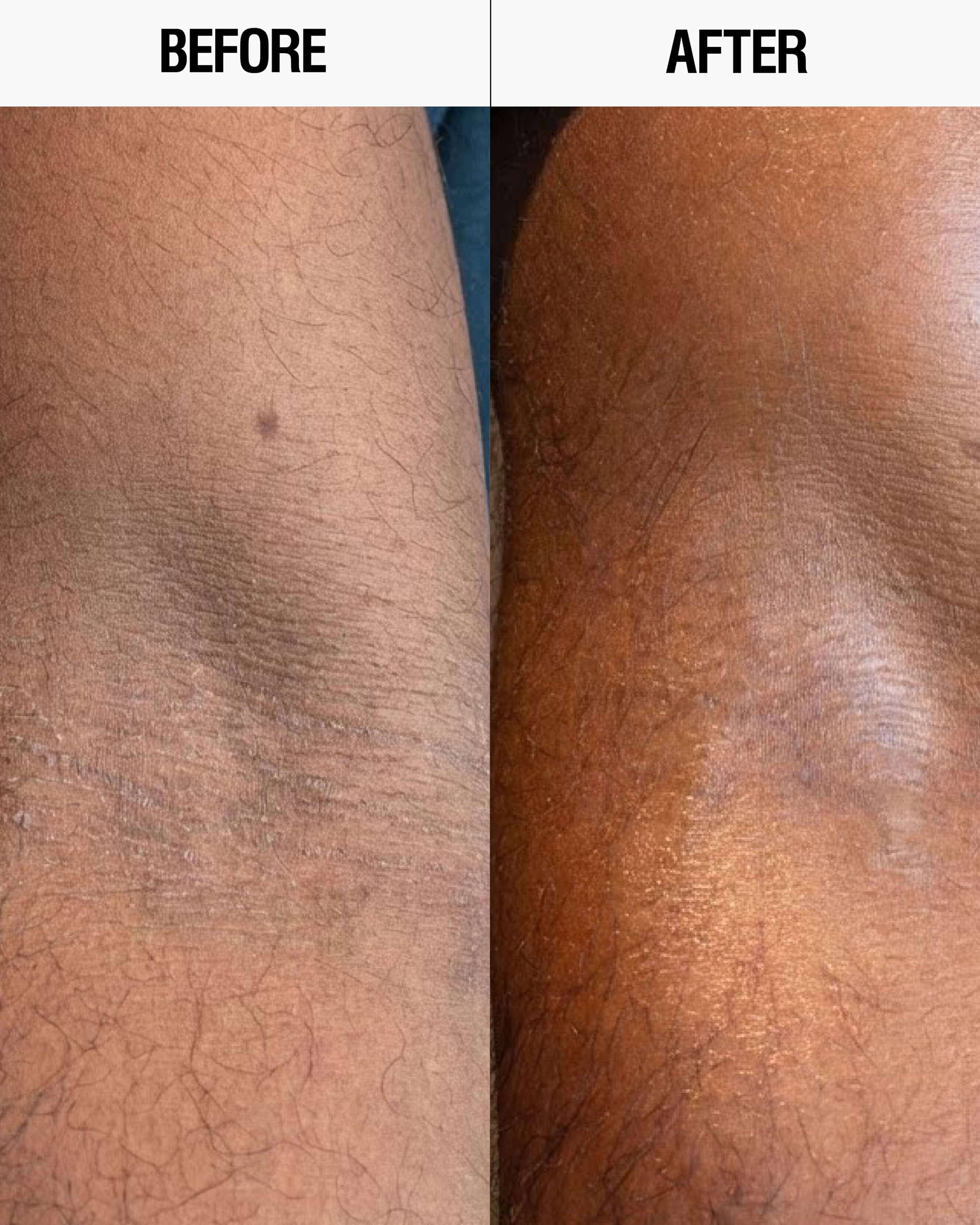 Grown Alchemist Resurfacing Targeted Body Lotion