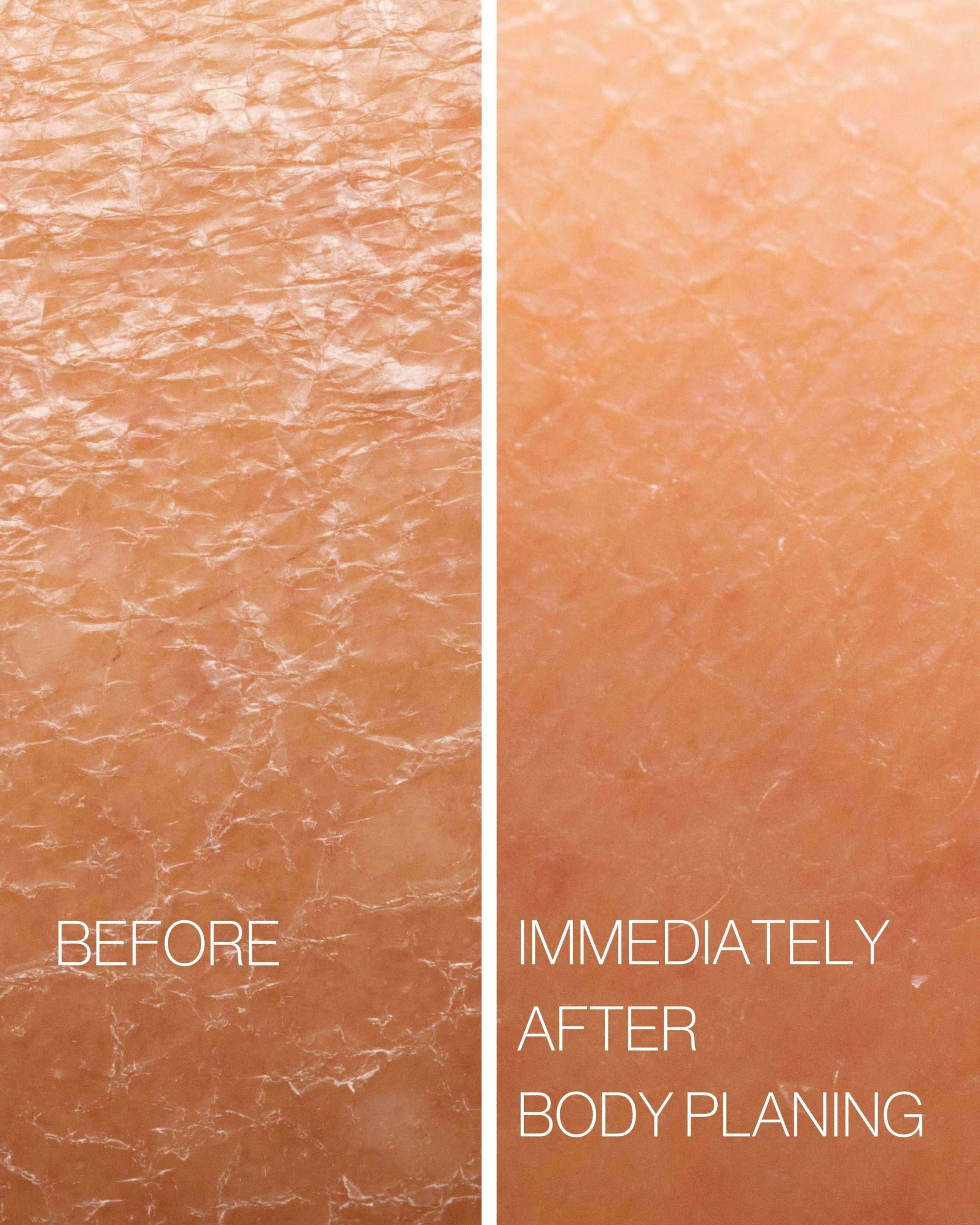 Esker Beauty Body Plane