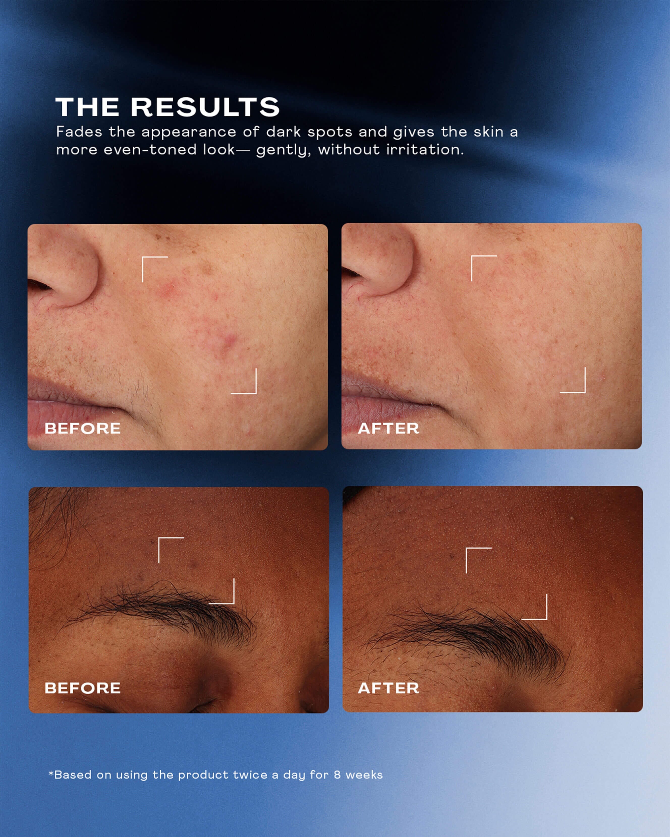 The Outset Total Clarity Dark Spot Serum