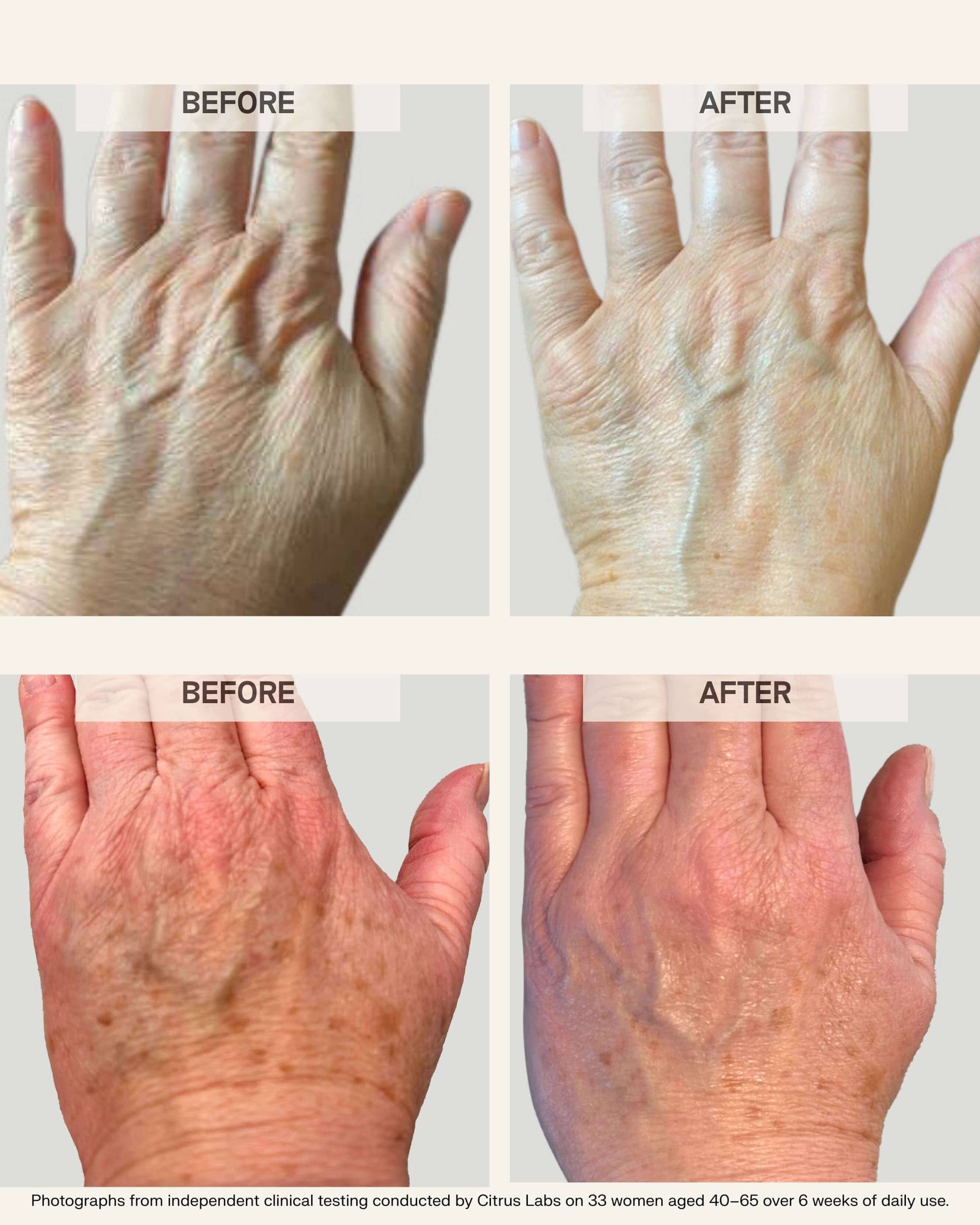 Habelo Beauty Power Pair: Activating Hand Serum + Treatment Boosting Gloves