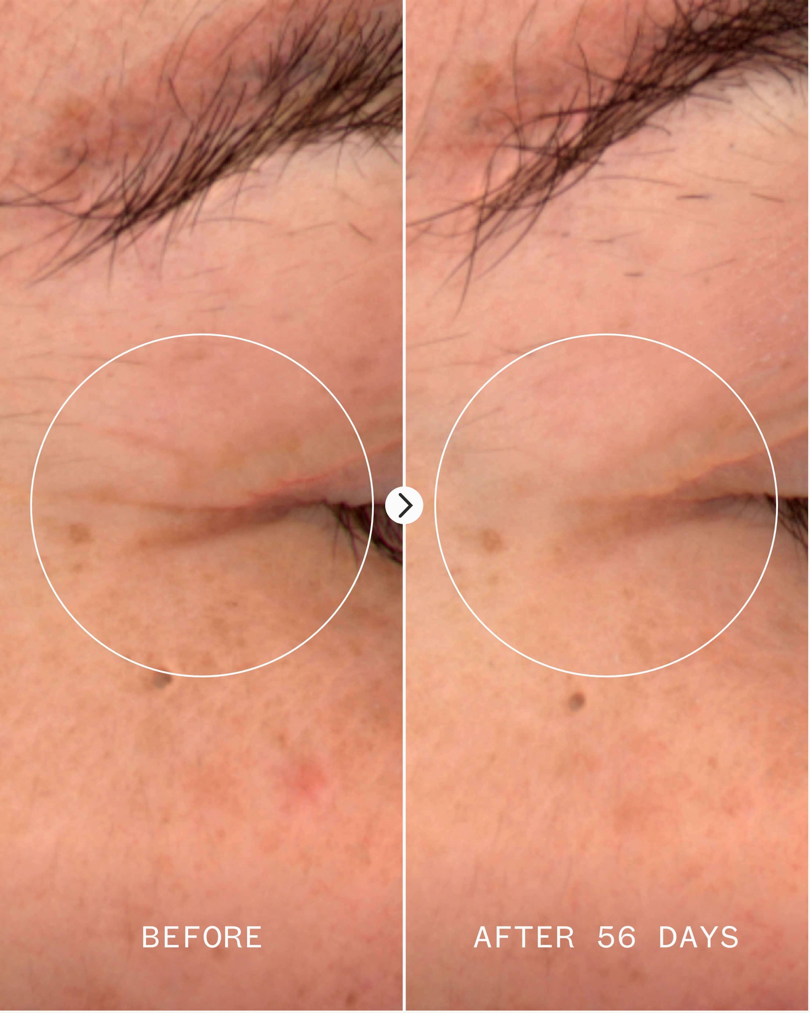 Pai Age Confidence NAD+ & Tri - peptide Serum