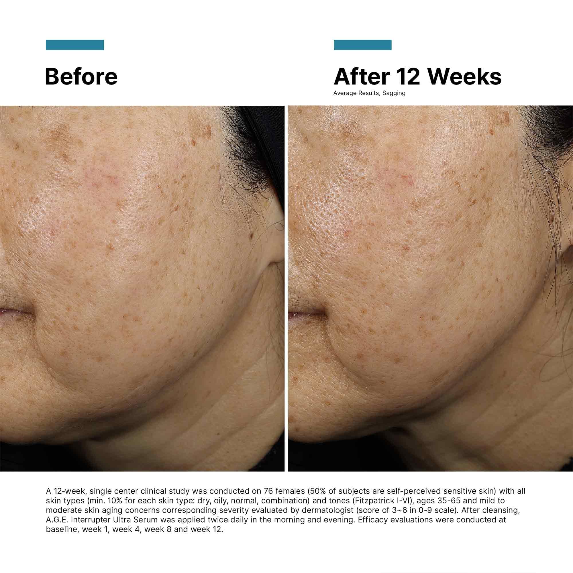 Skinceuticals A.G.E. Interrupter Ultra Lifting Serum