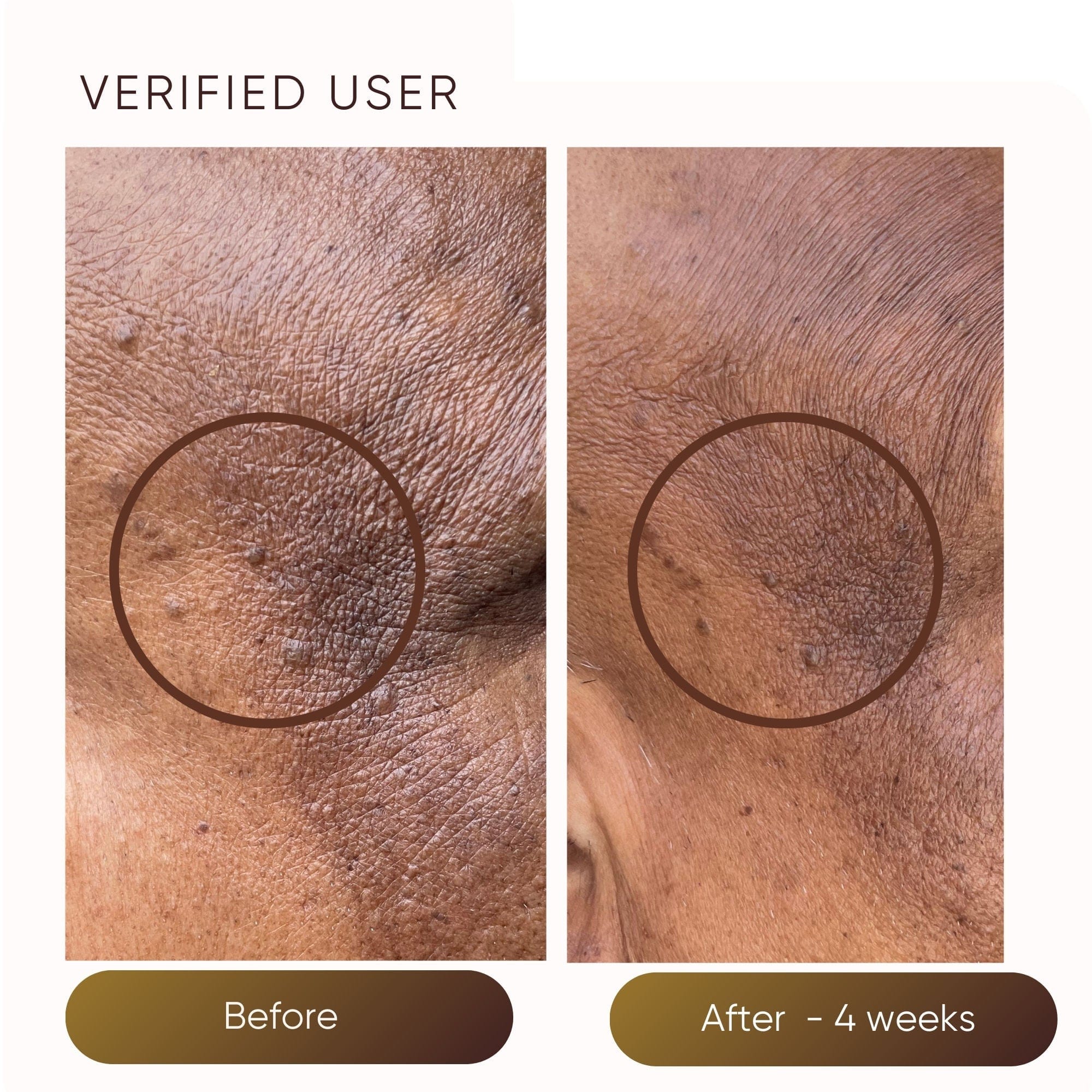 Plantkos Hydrating Moisturizer
