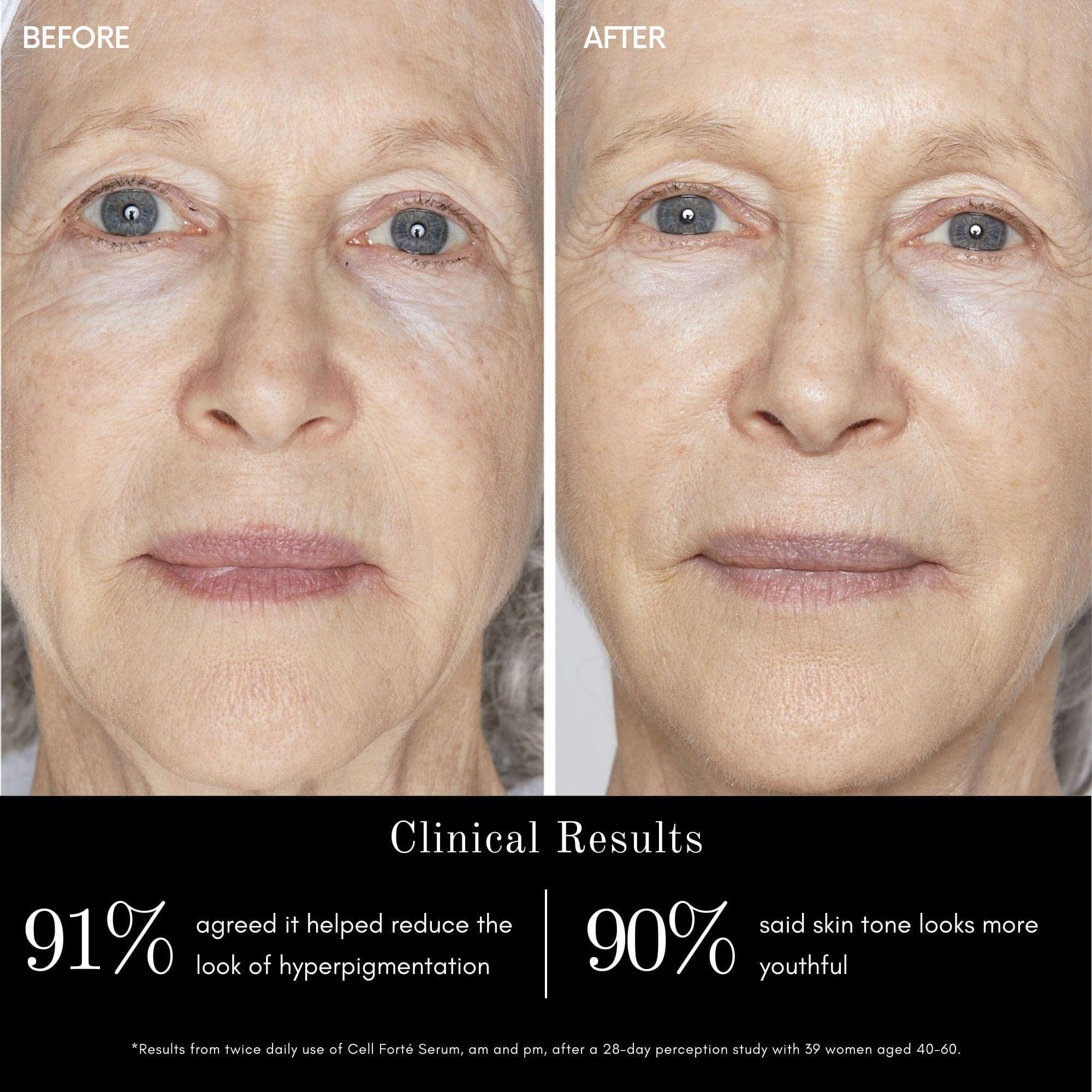 Angela Caglia Skincare Cell Forté Serum with BIOMSC™