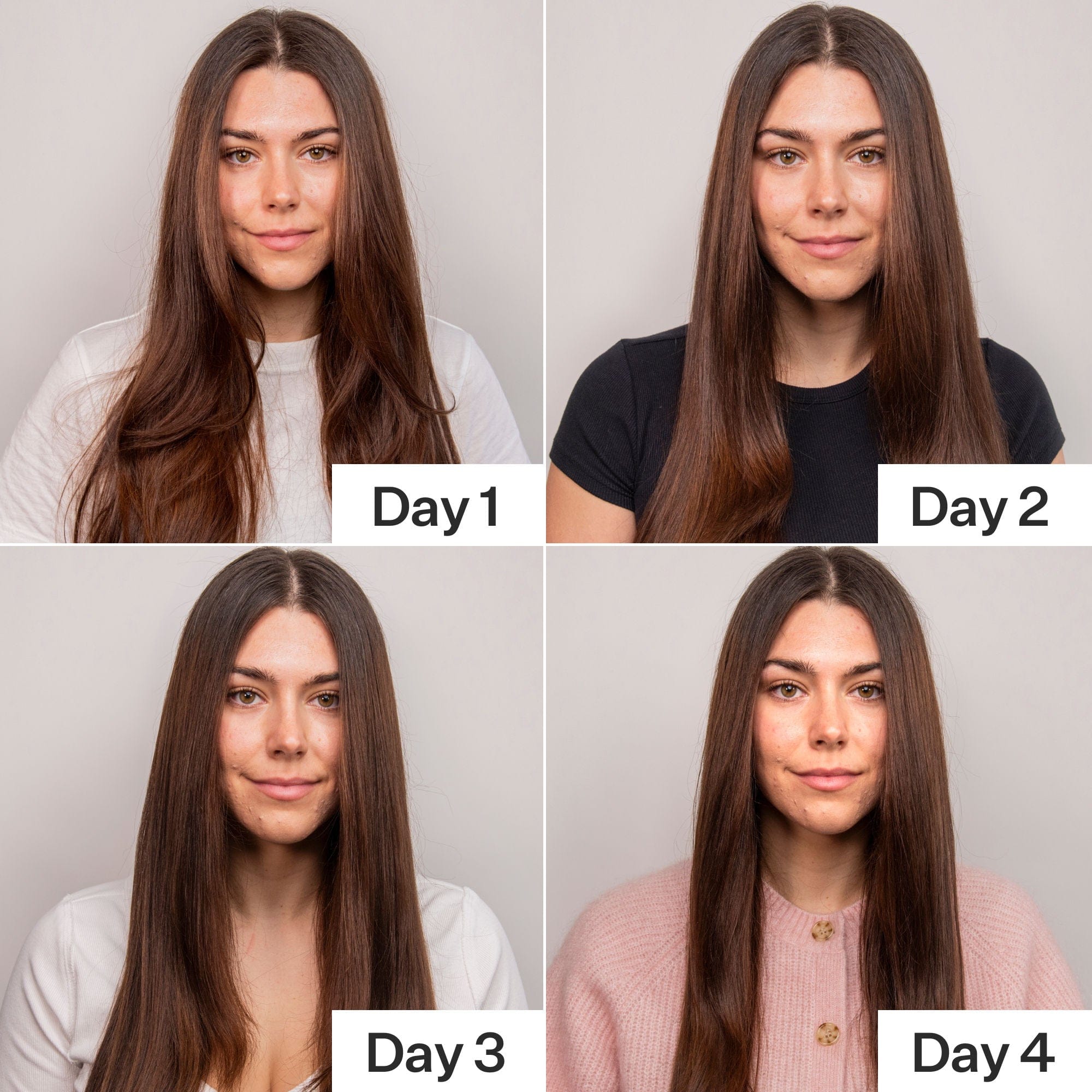 Act+acre 4% Niacinamide Oily Scalp Serum