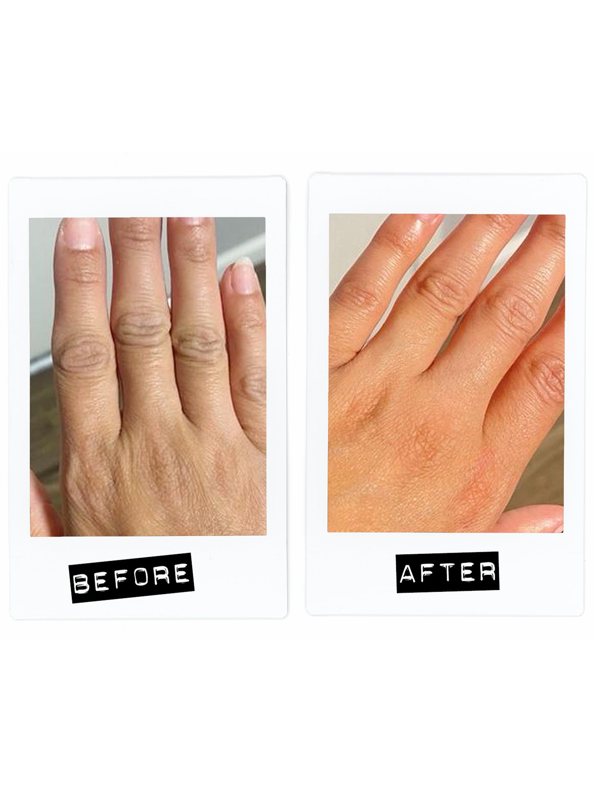 Habelo Power Pair: Activating Hand Serum + Treatment - Boosting Gloves