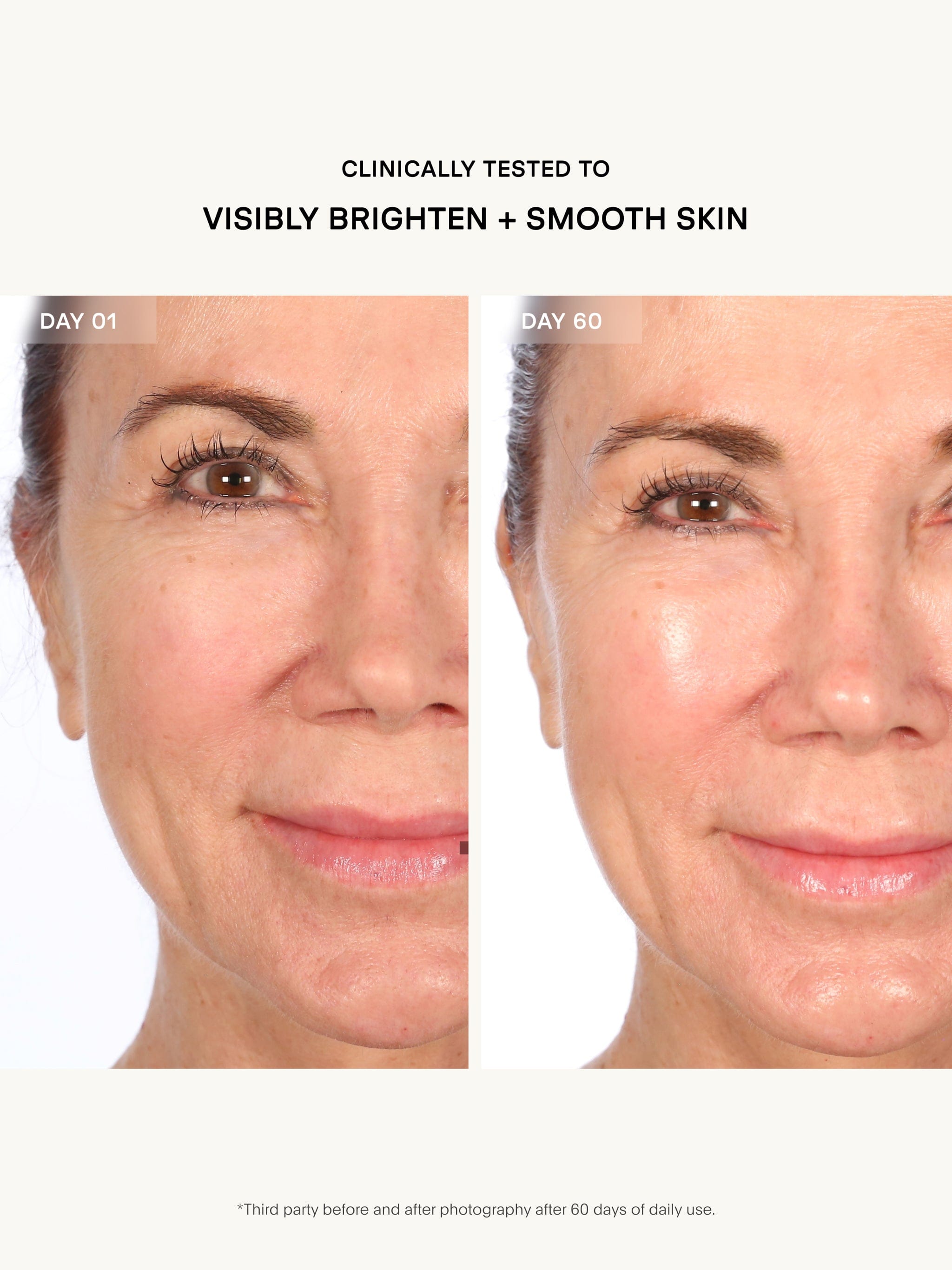 U Beauty Resurfacing Flash Peel
