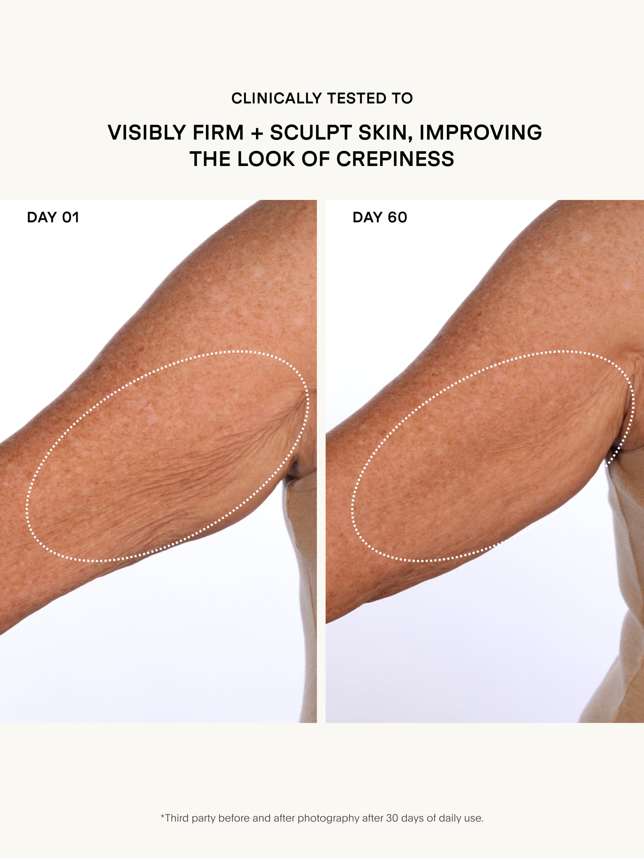 U Beauty The Sculpt Arm Compound