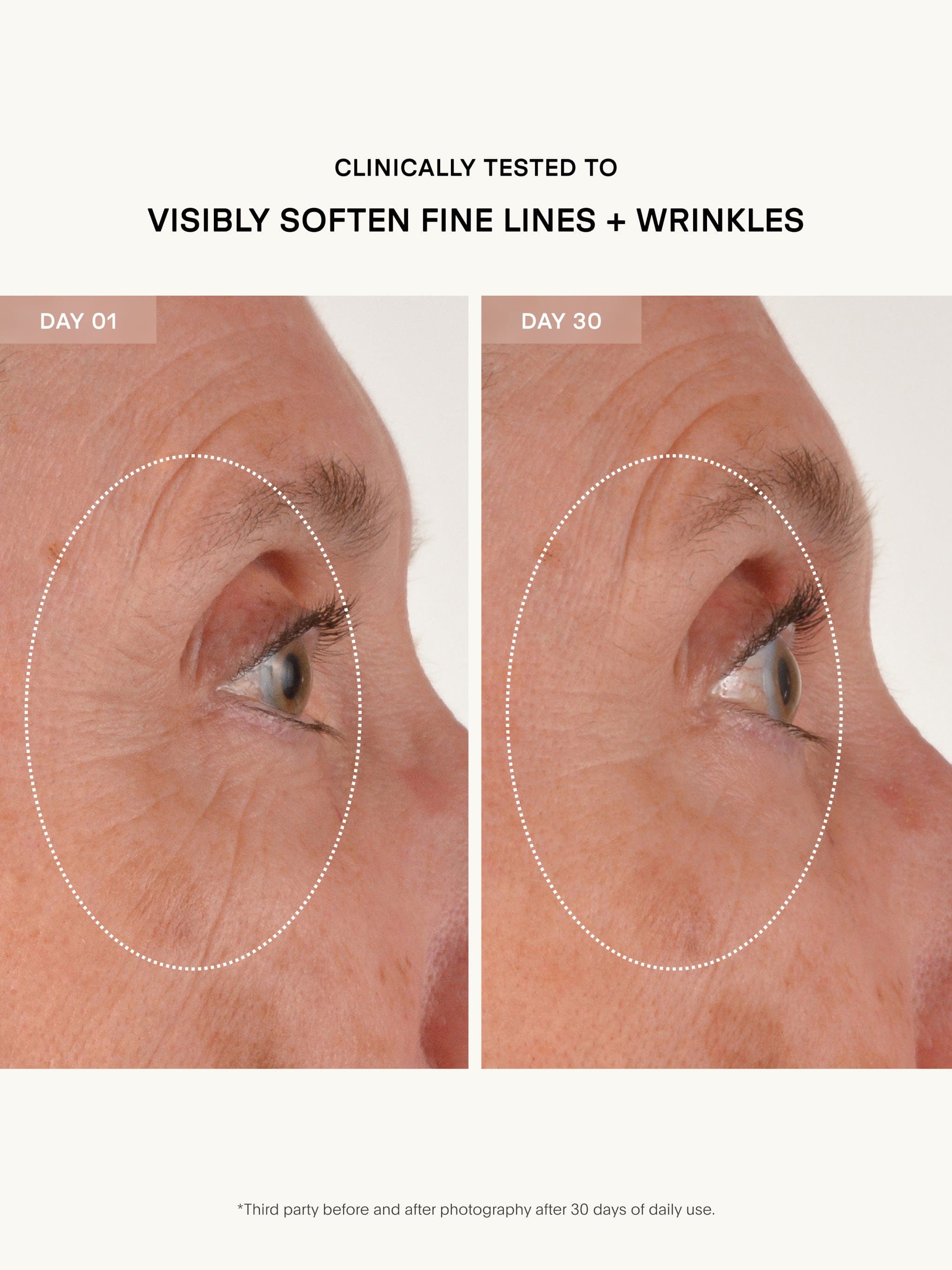 U Beauty The RETURN Eye Concentrate