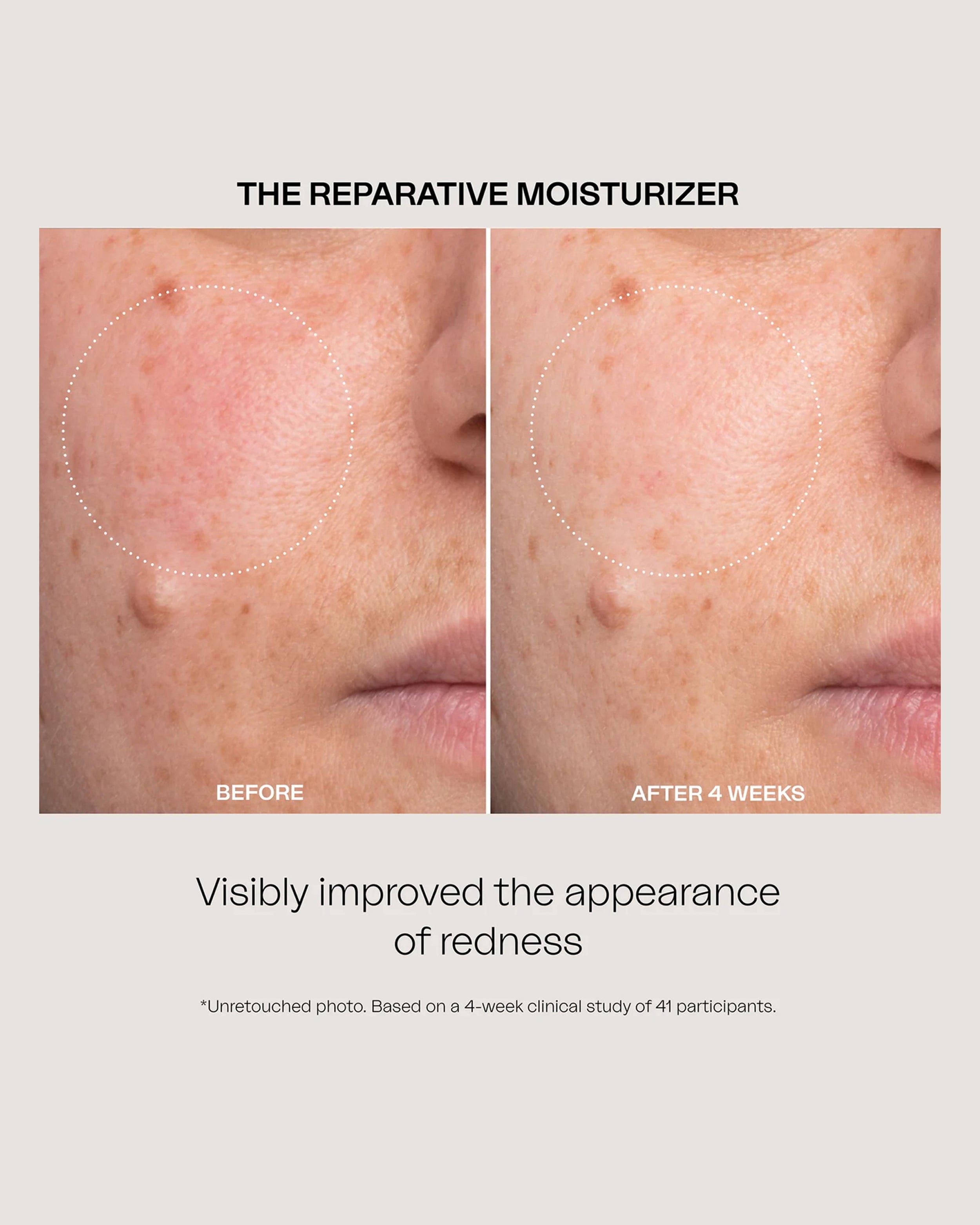 Eighth Day Reparative Moisturizer