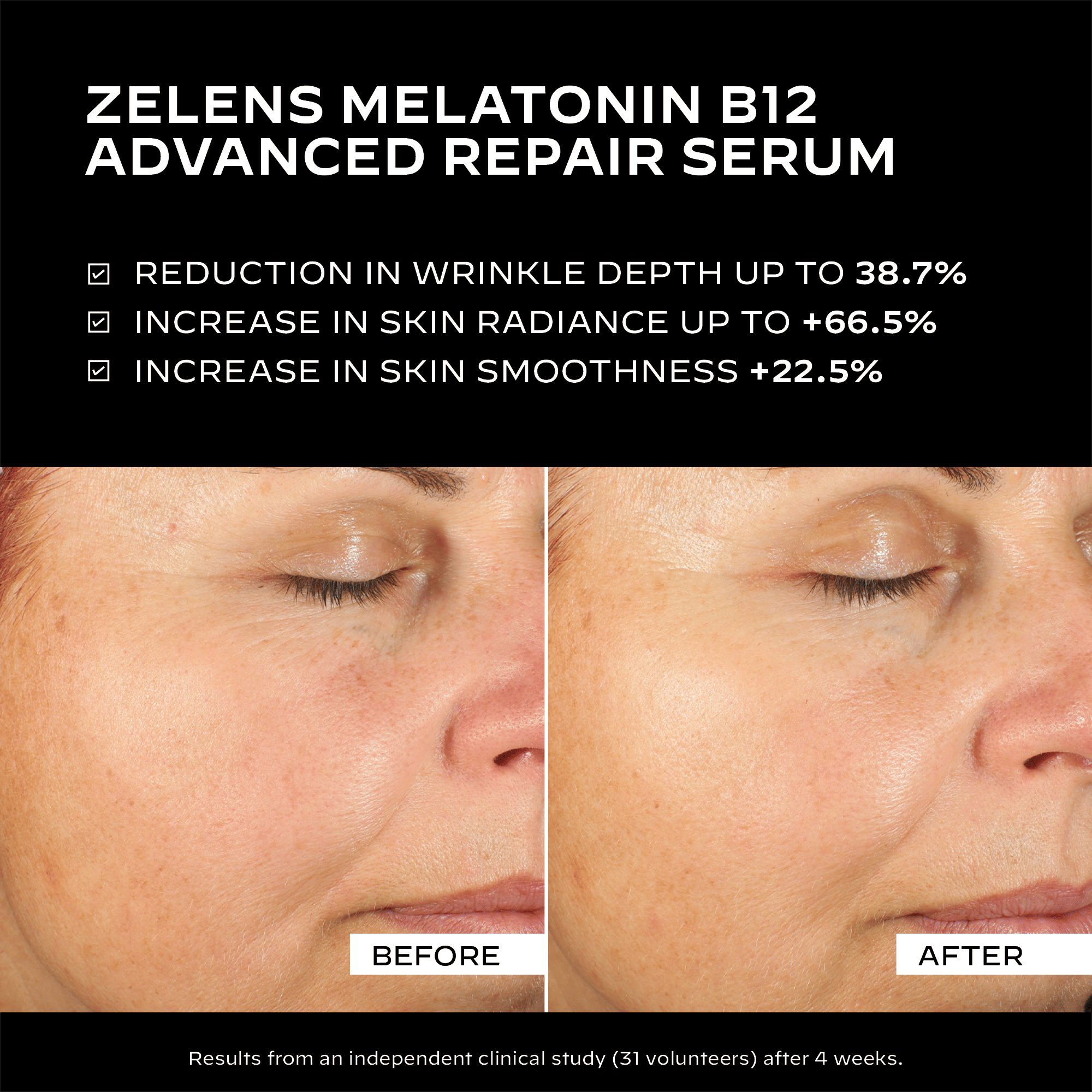 Zelens Melatonin B12 - Advanced Repair Serum