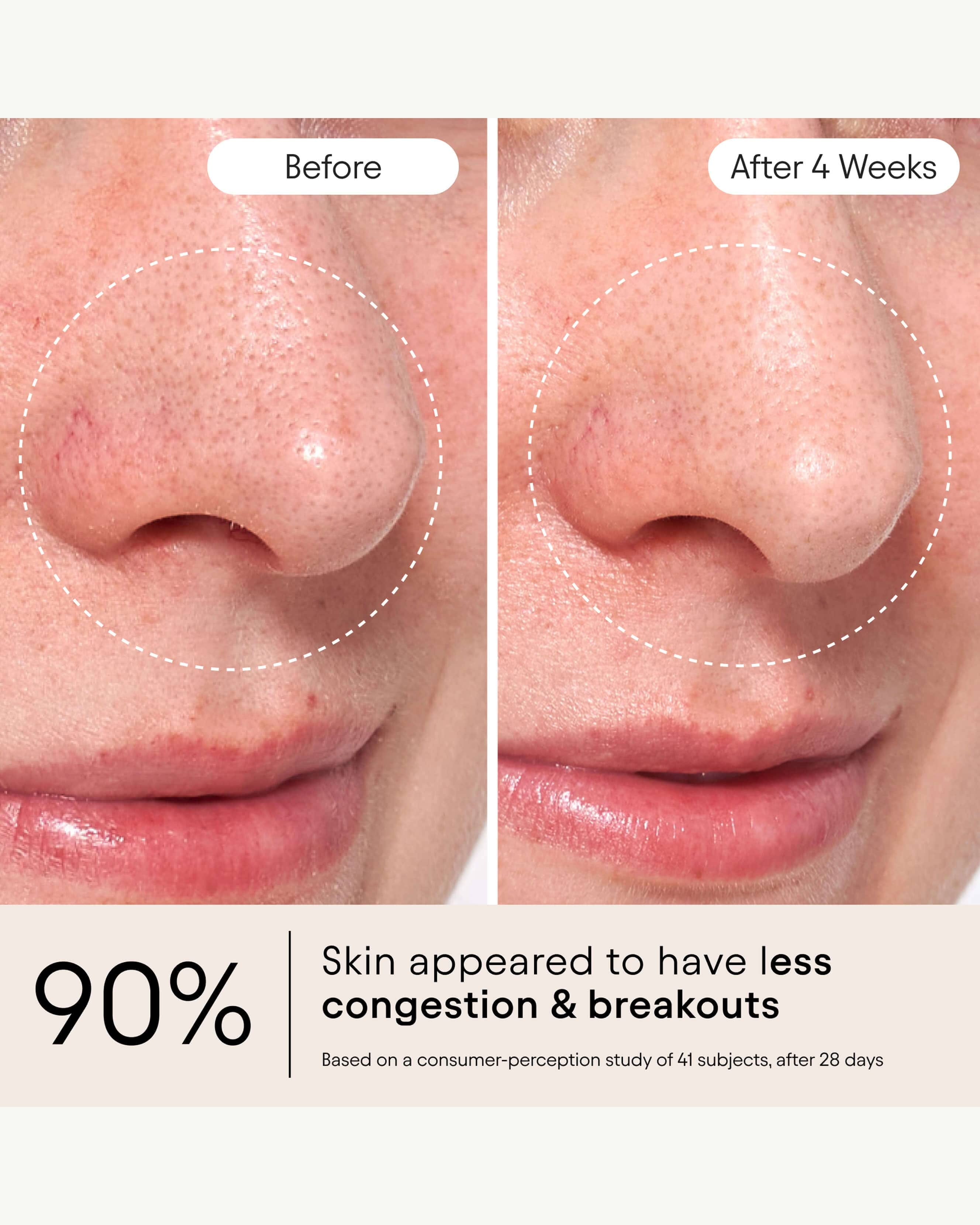 Alpyn Beauty Clarifying Facial Oil with Retinol & Pink Algae