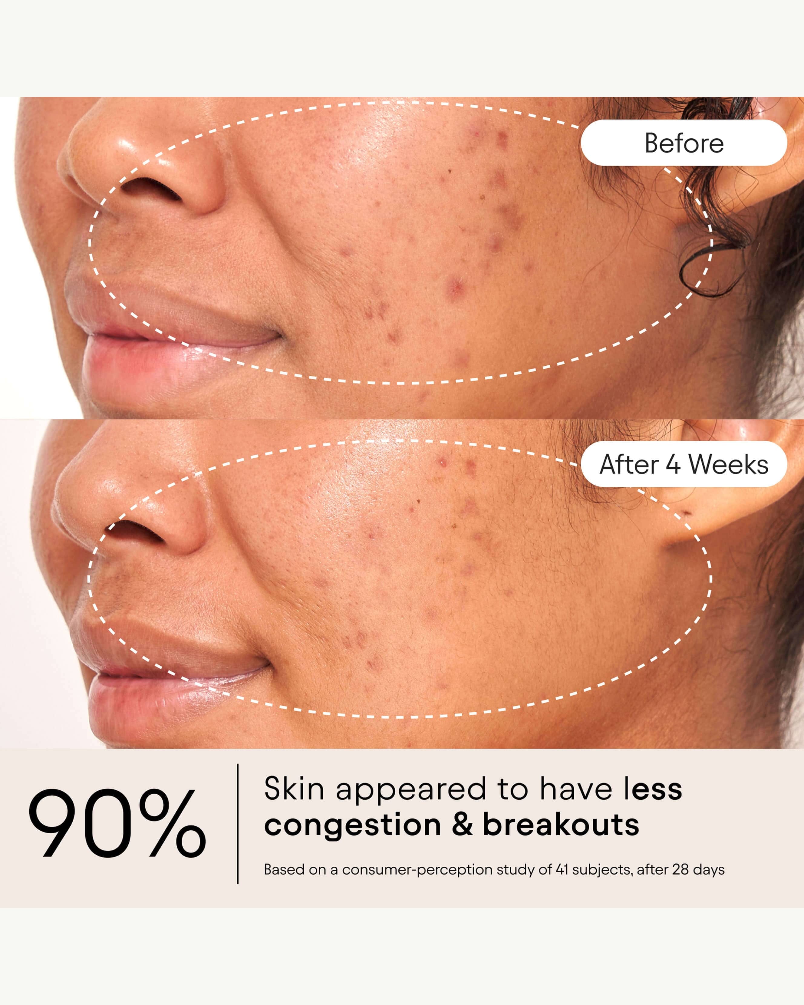 Alpyn Beauty Clarifying Facial Oil with Retinol & Pink Algae