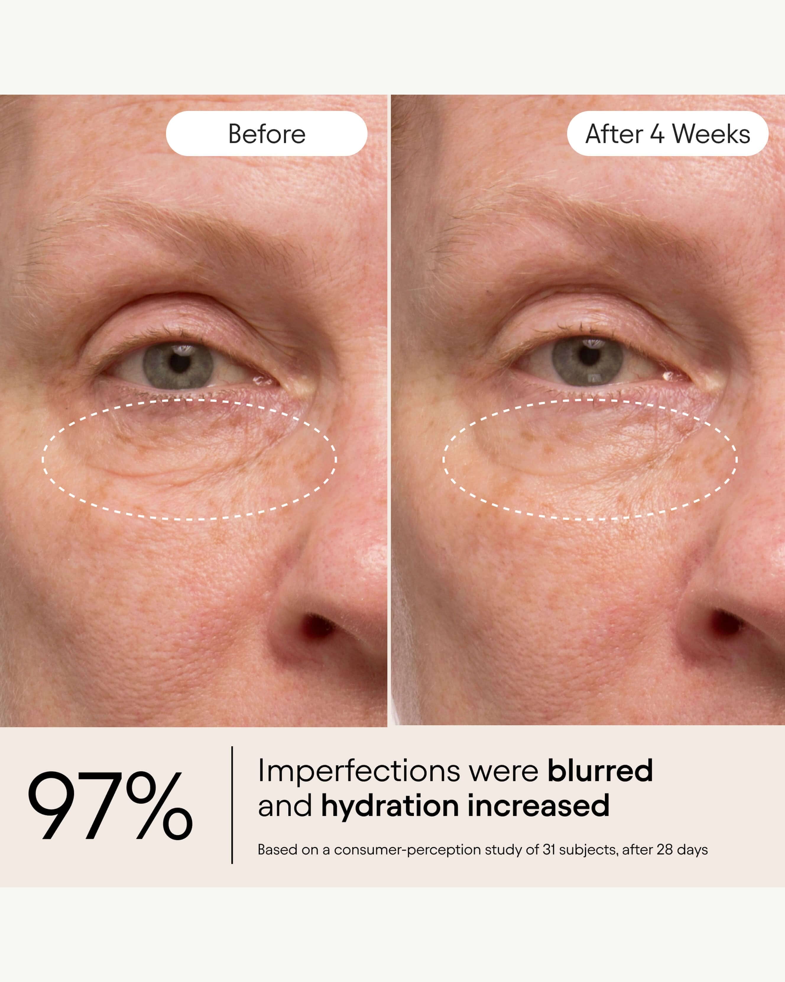 Alpyn Beauty Instant Bright Eye with Peptides & Niacinamide