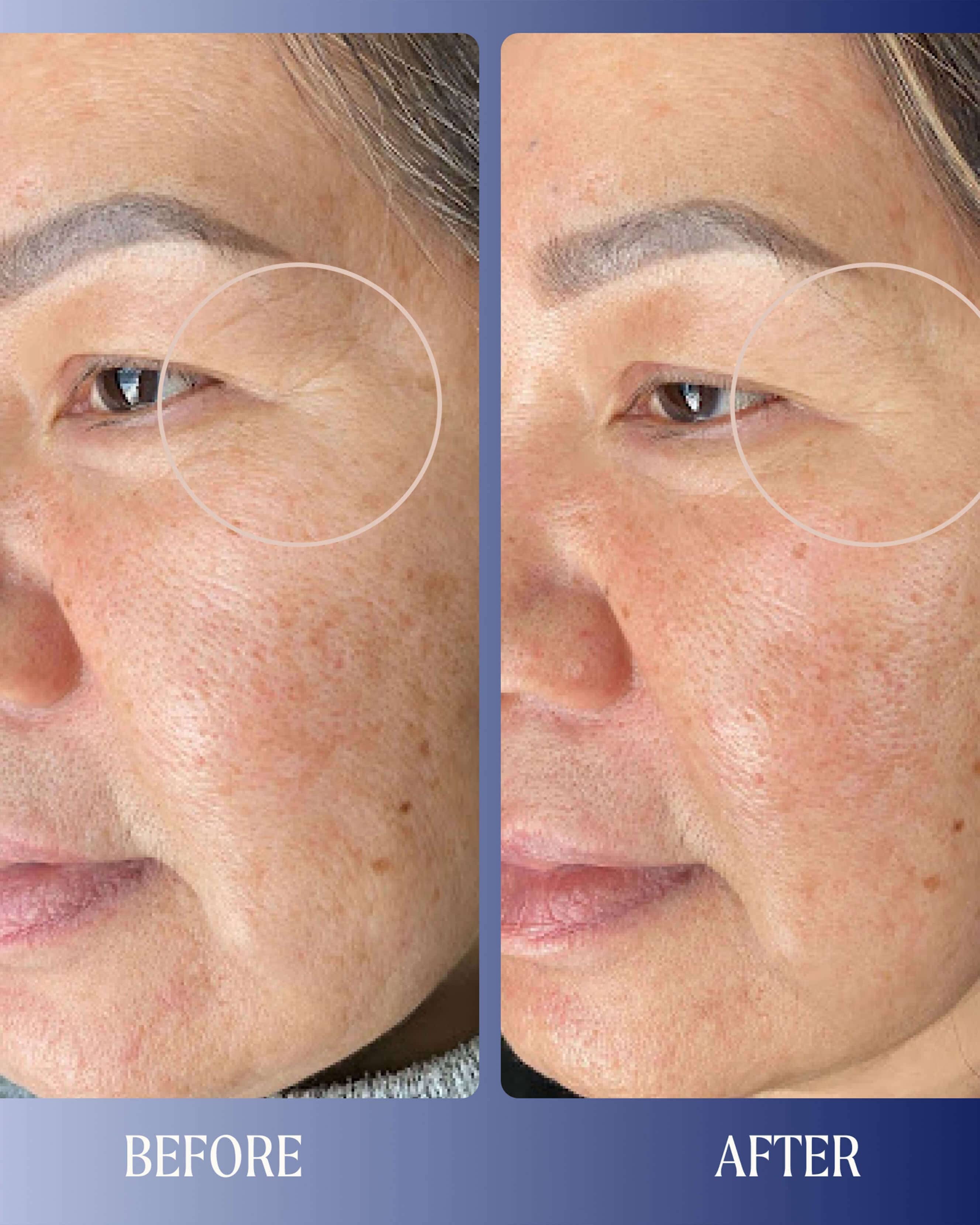 Kinship Dreamwave 2% Bio - Retinoid Complex Overnight Serum