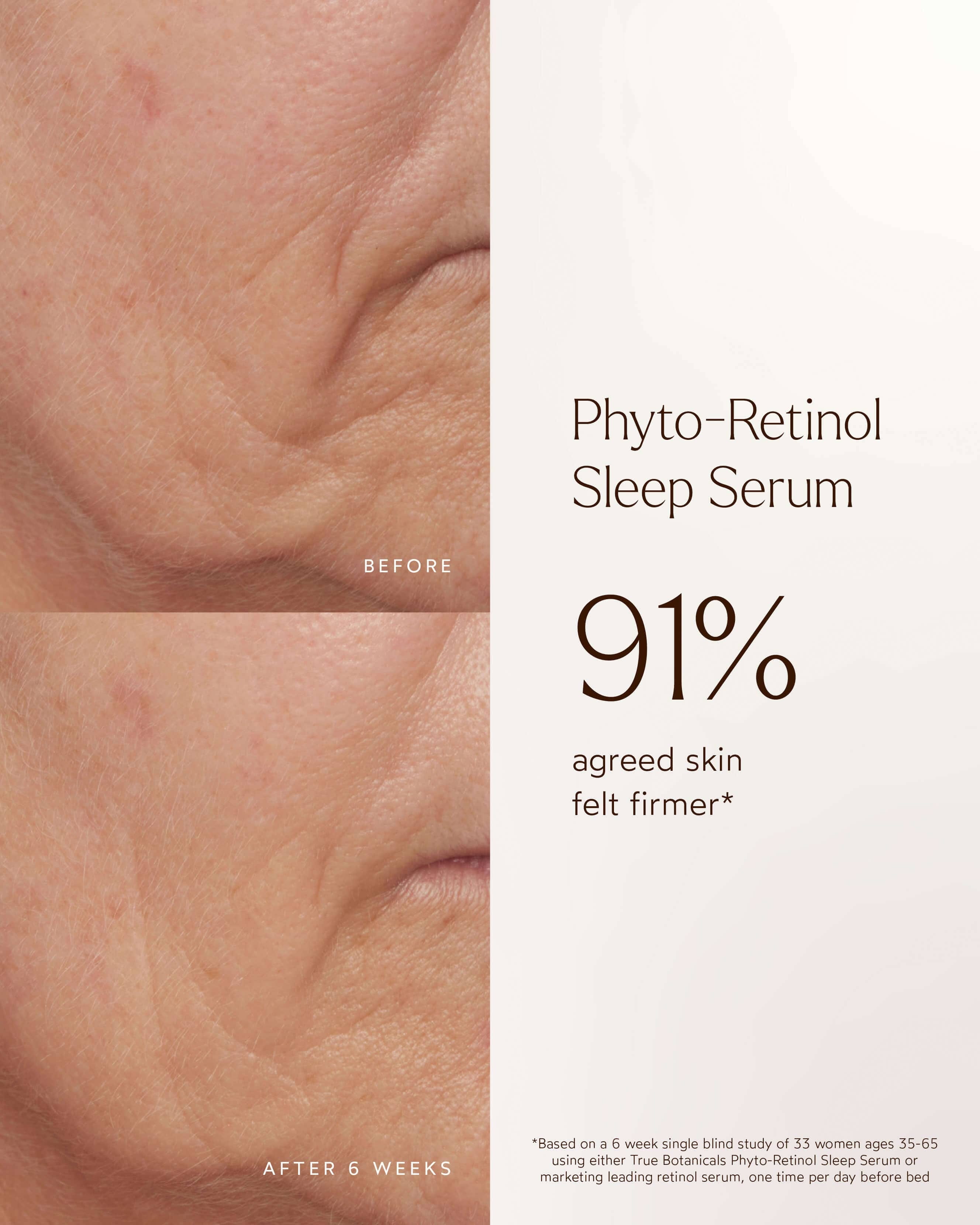 True Botanicals Phyto Retinol Anti - Aging Sleep Serum